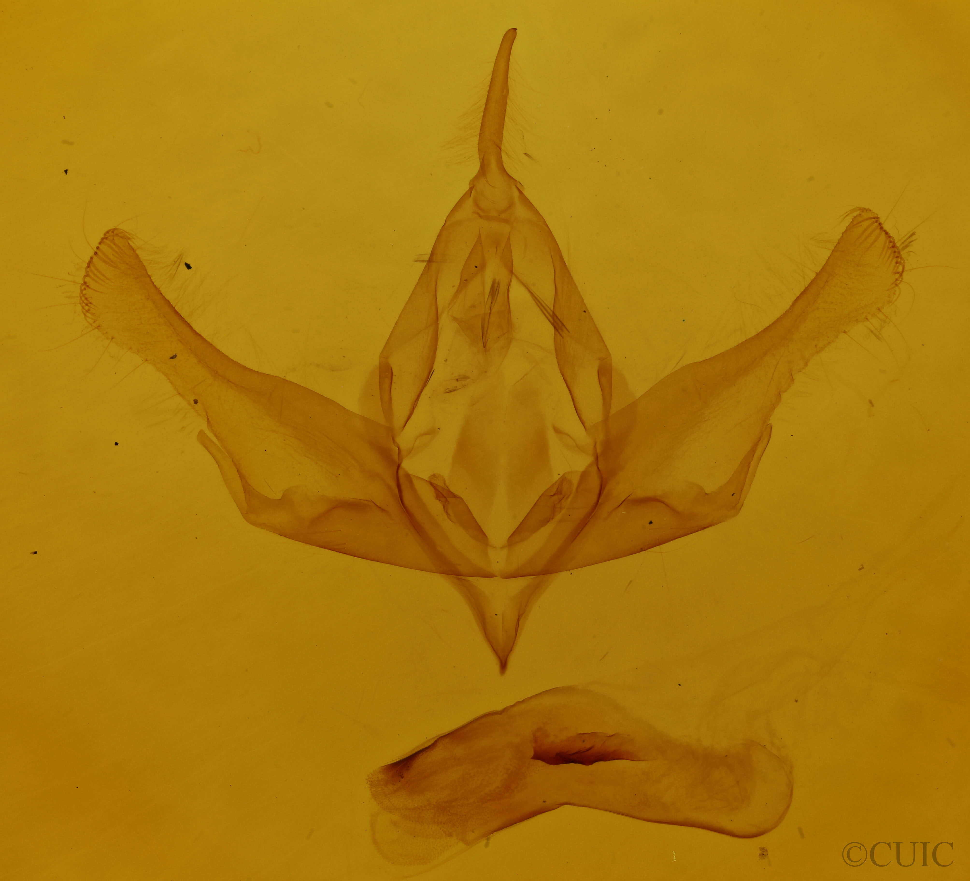 genitalia view of adult Lamprosticta culta