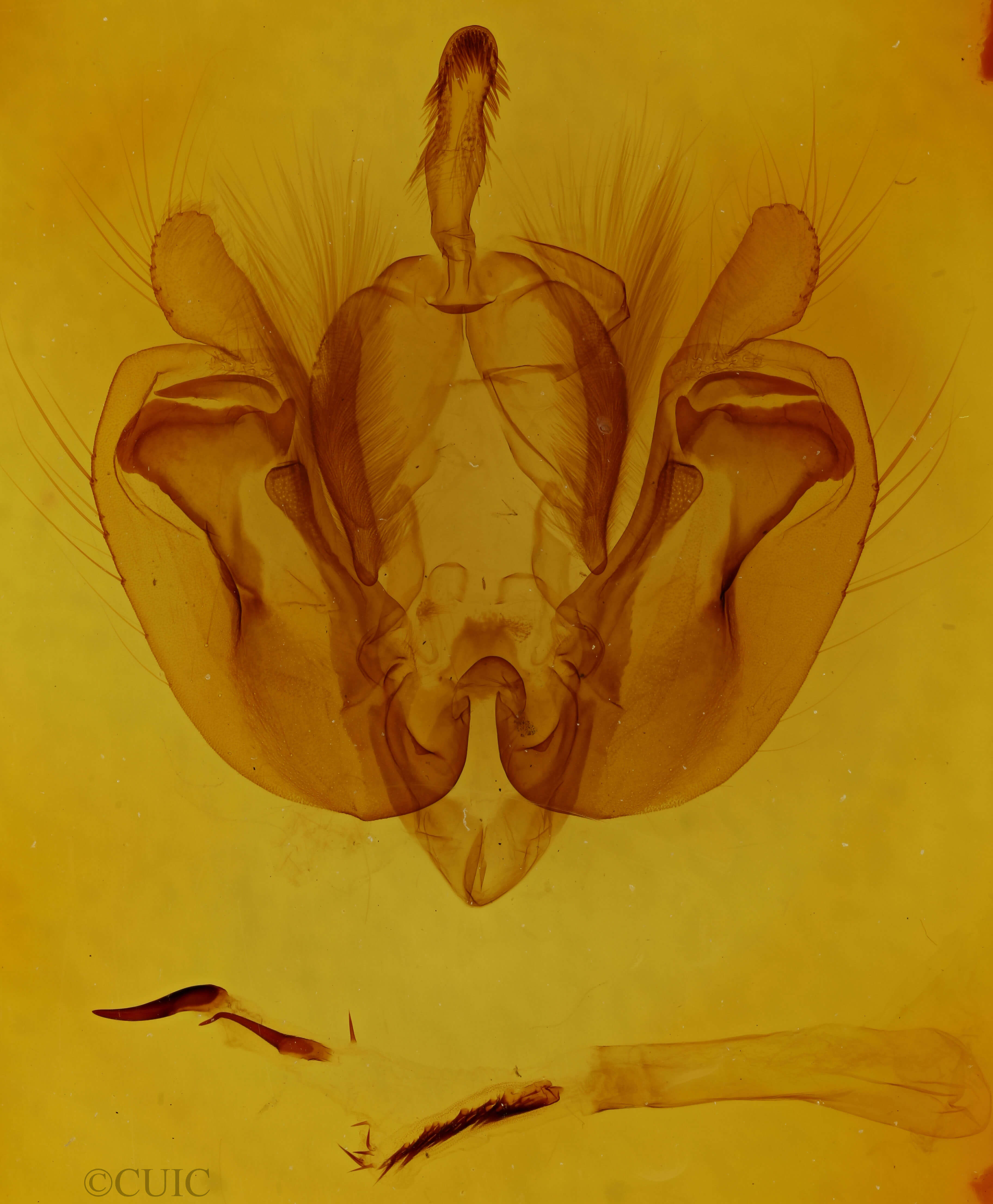 genitalia view of adult Leucania inermis