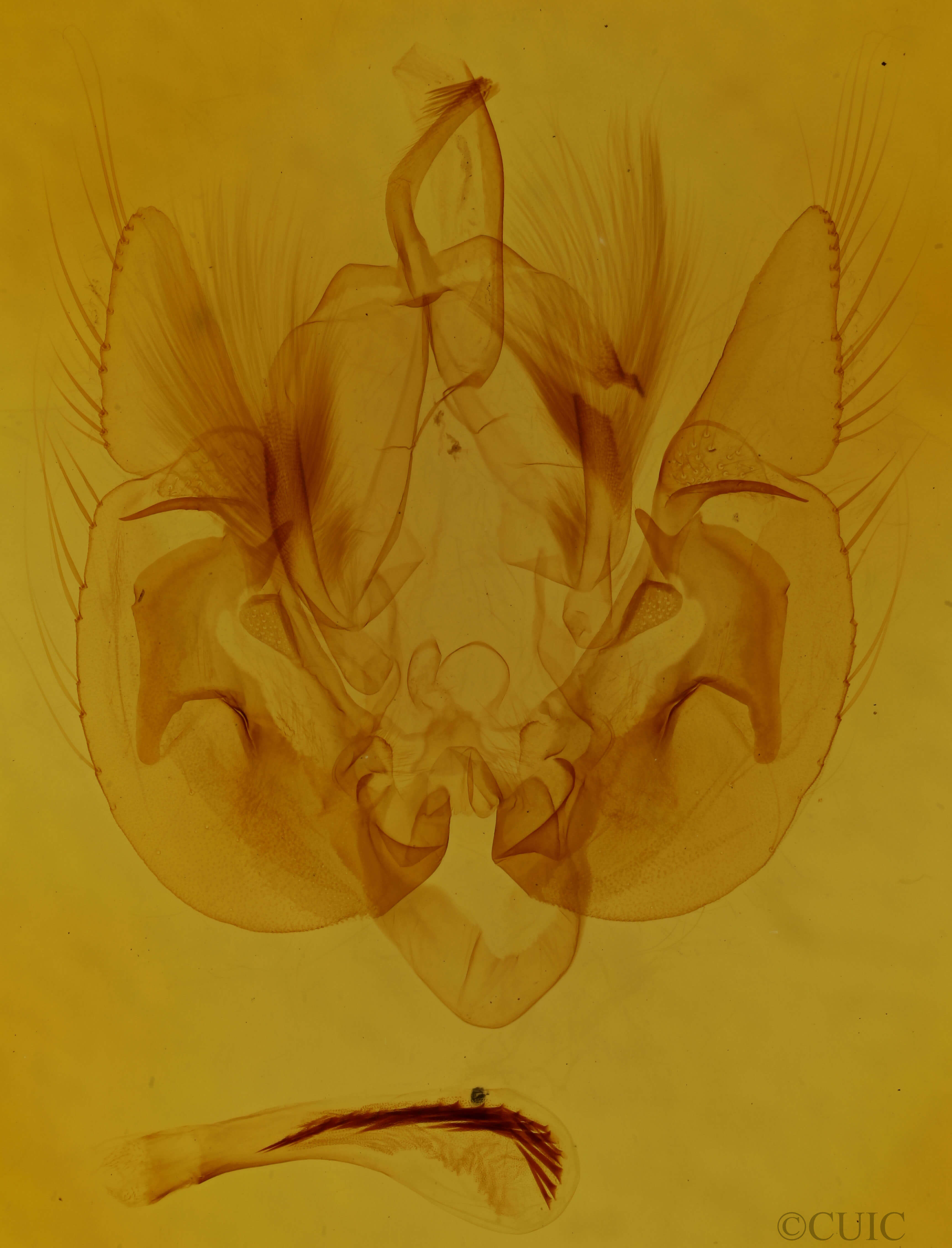 genitalia view of adult Leucania lapidaria