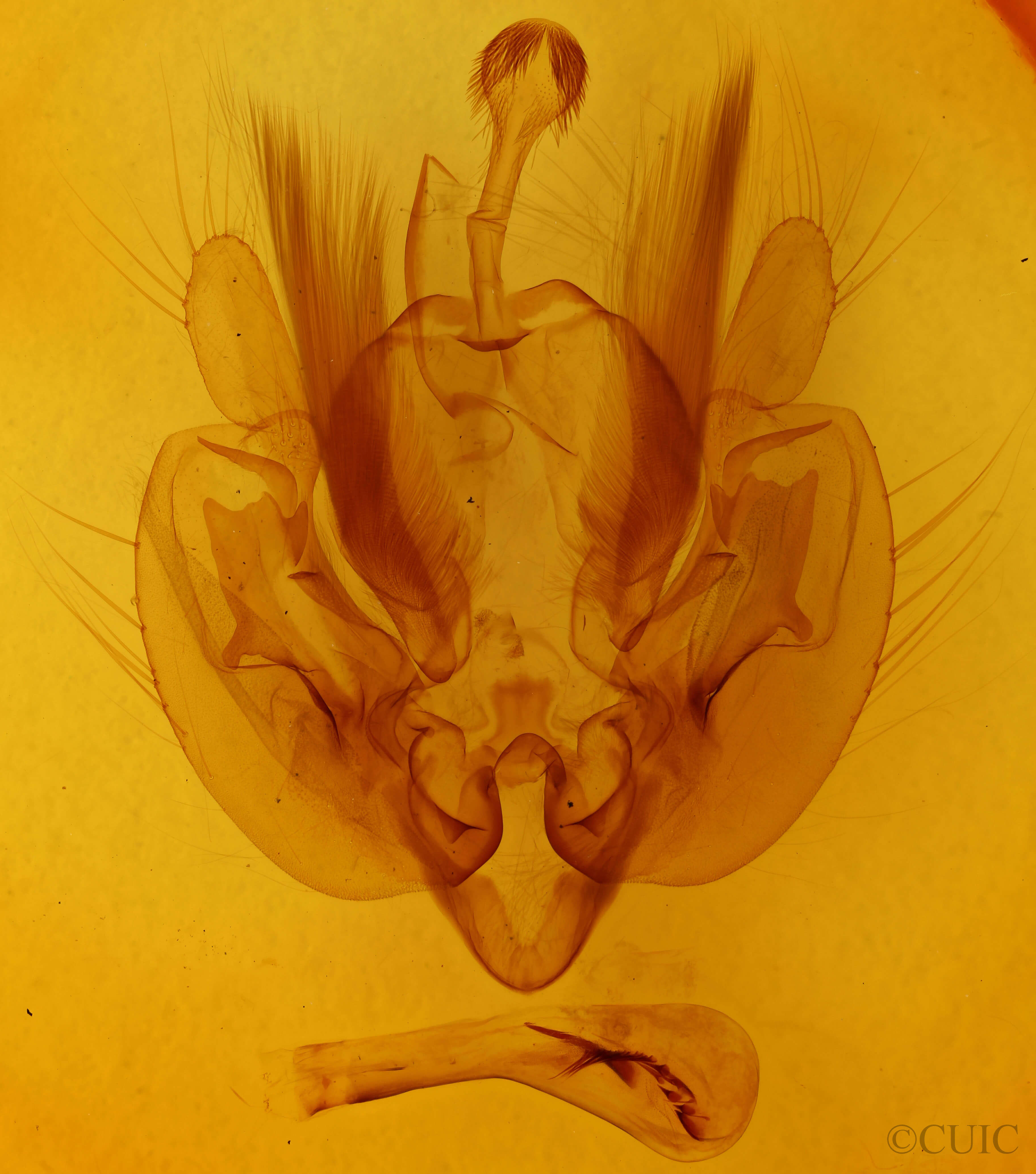 genitalia view of adult Leucania pseudargyria