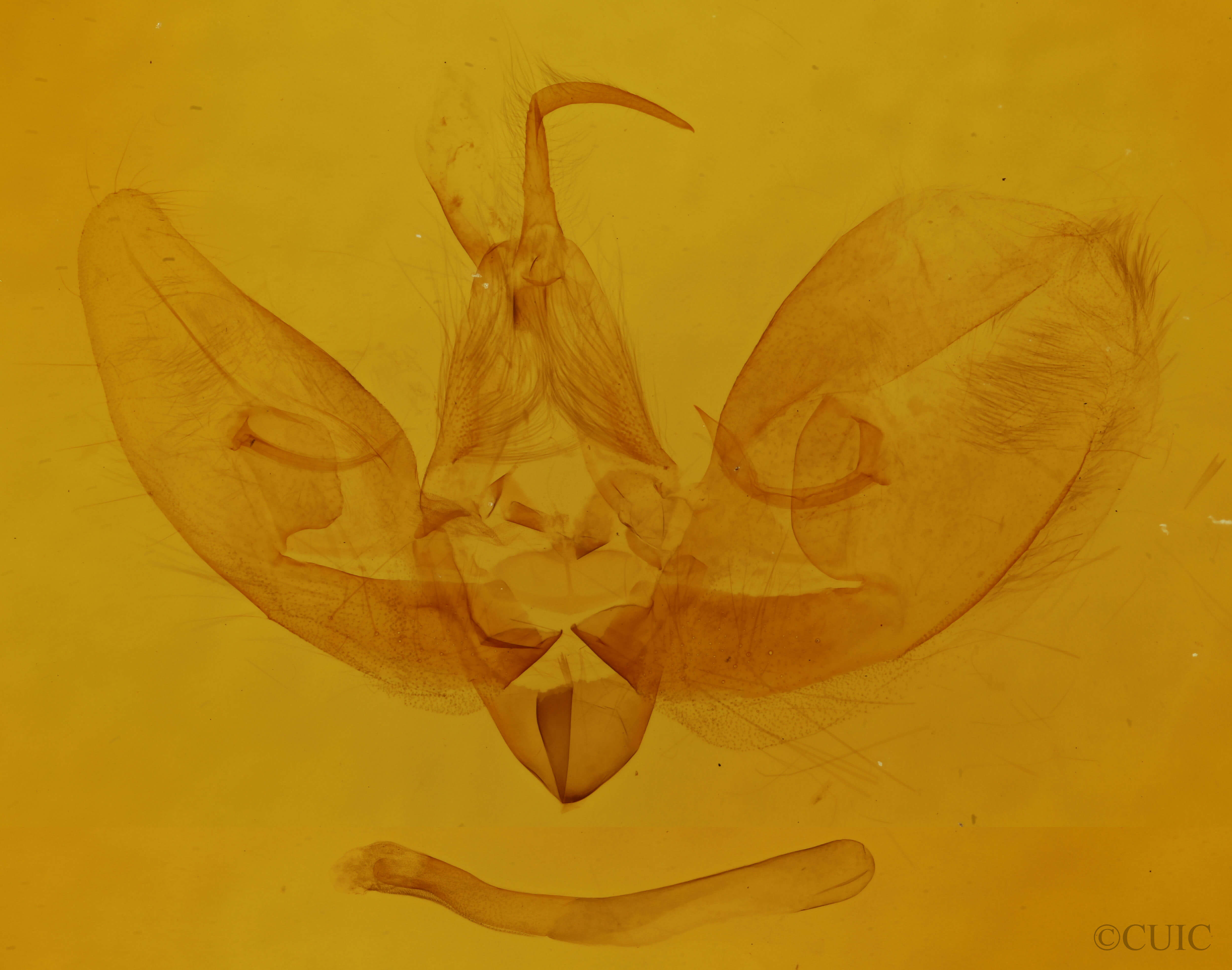 genitalia view of adult Leuconycta diphteroides