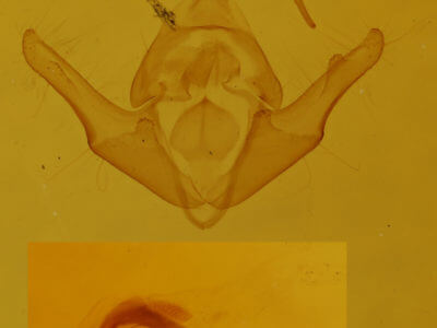 genitalia view of adult Protodeltote muscosula