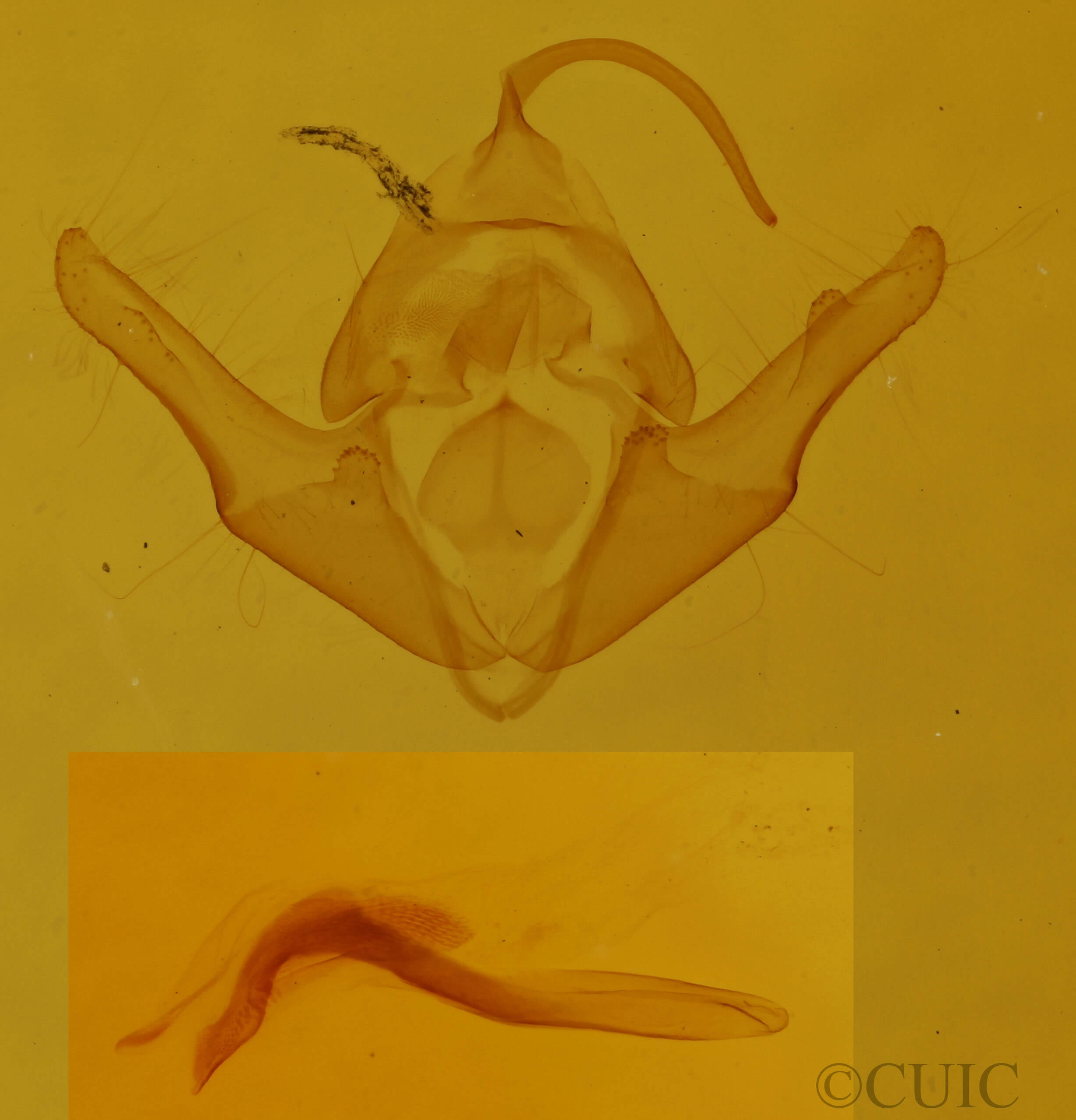 genitalia view of adult Protodeltote muscosula