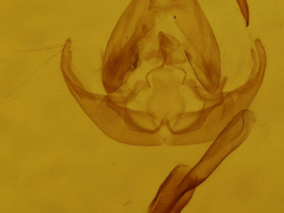 genitalia view of adult Lithacodia musta