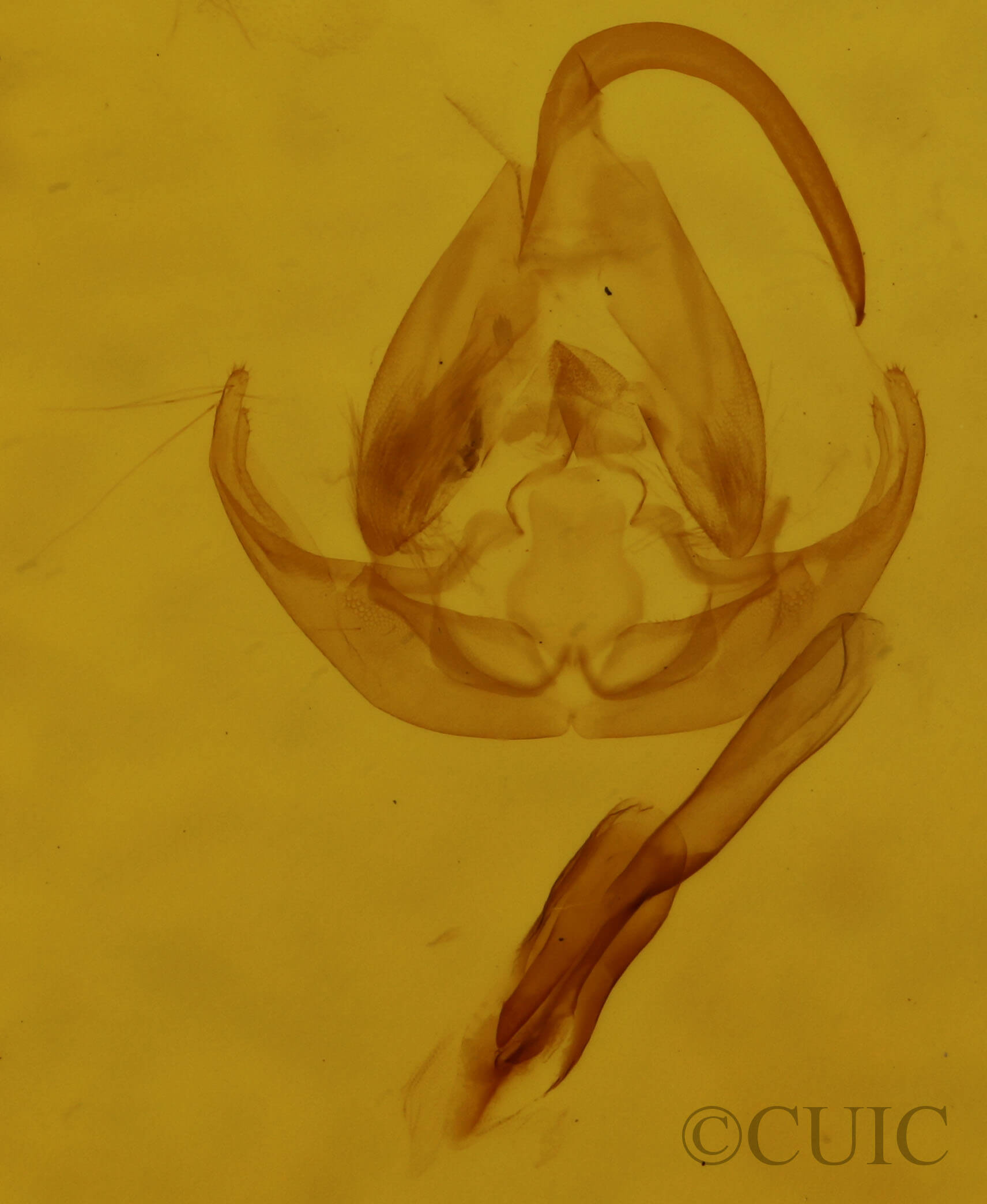 genitalia view of adult Lithacodia musta