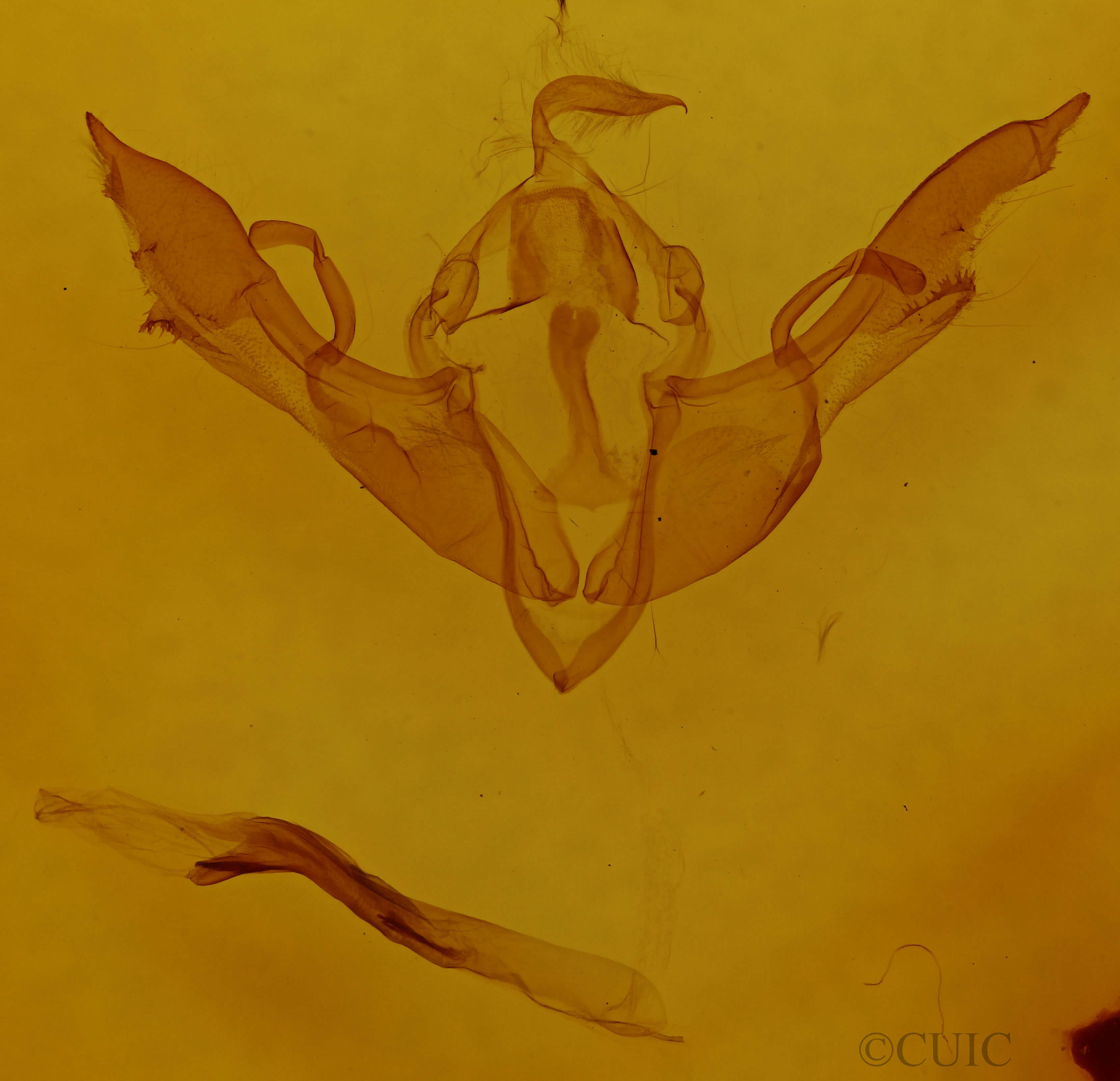 genitalia view of adult Lithophane antennata