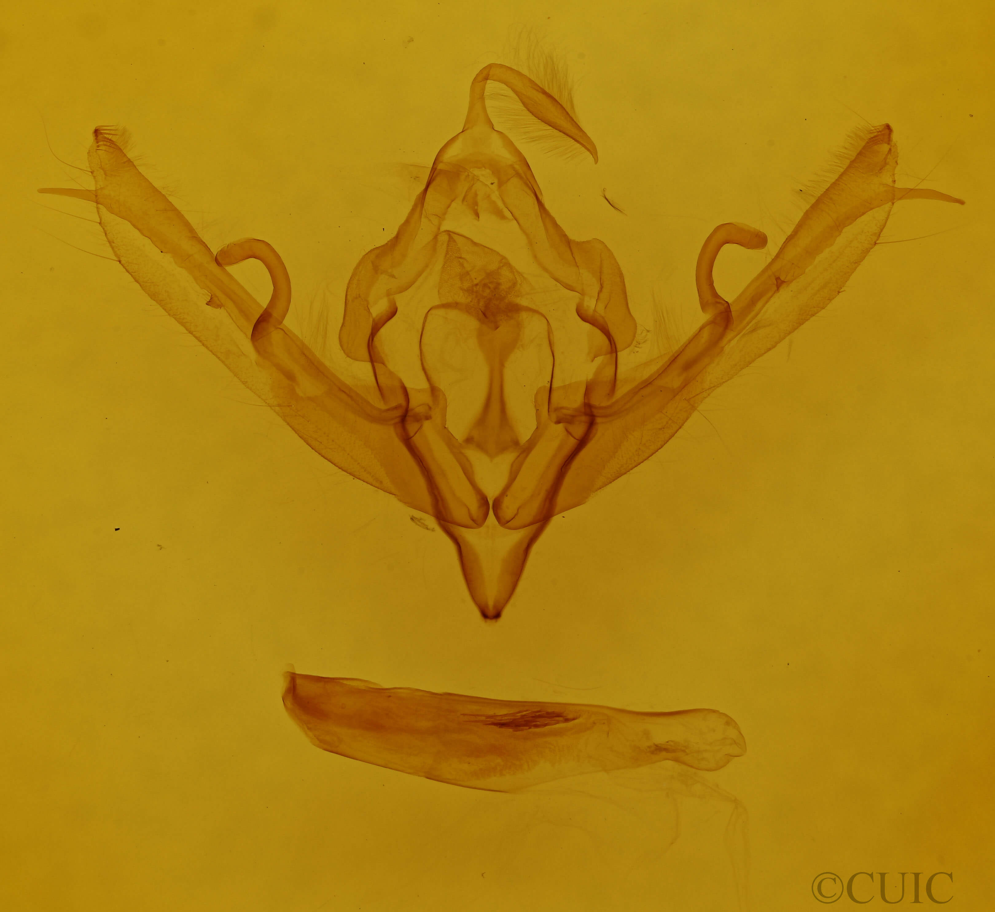 genitalia view of adult Lithophane signosa