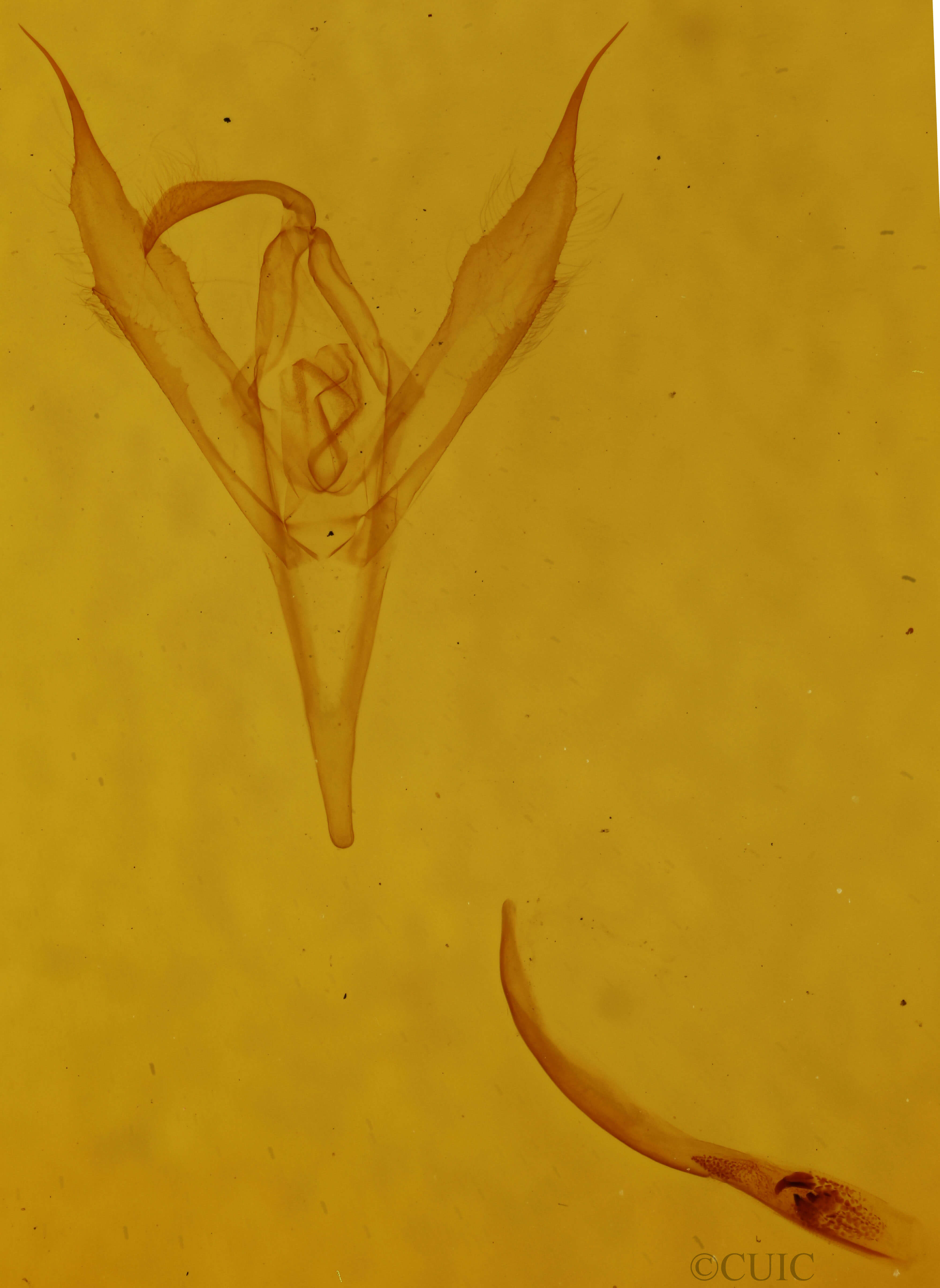 genitalia view of adult Macrochilo absorptalis
