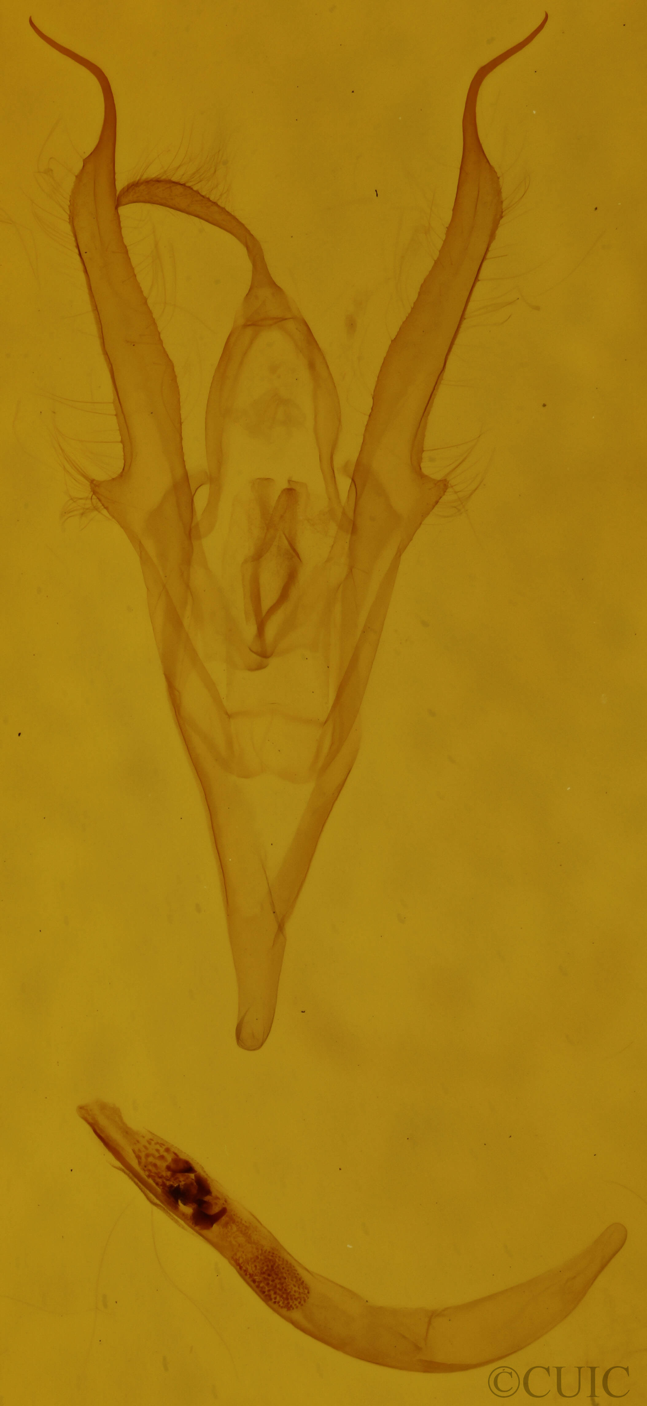 genitalia view of adult Macrochilo litophora