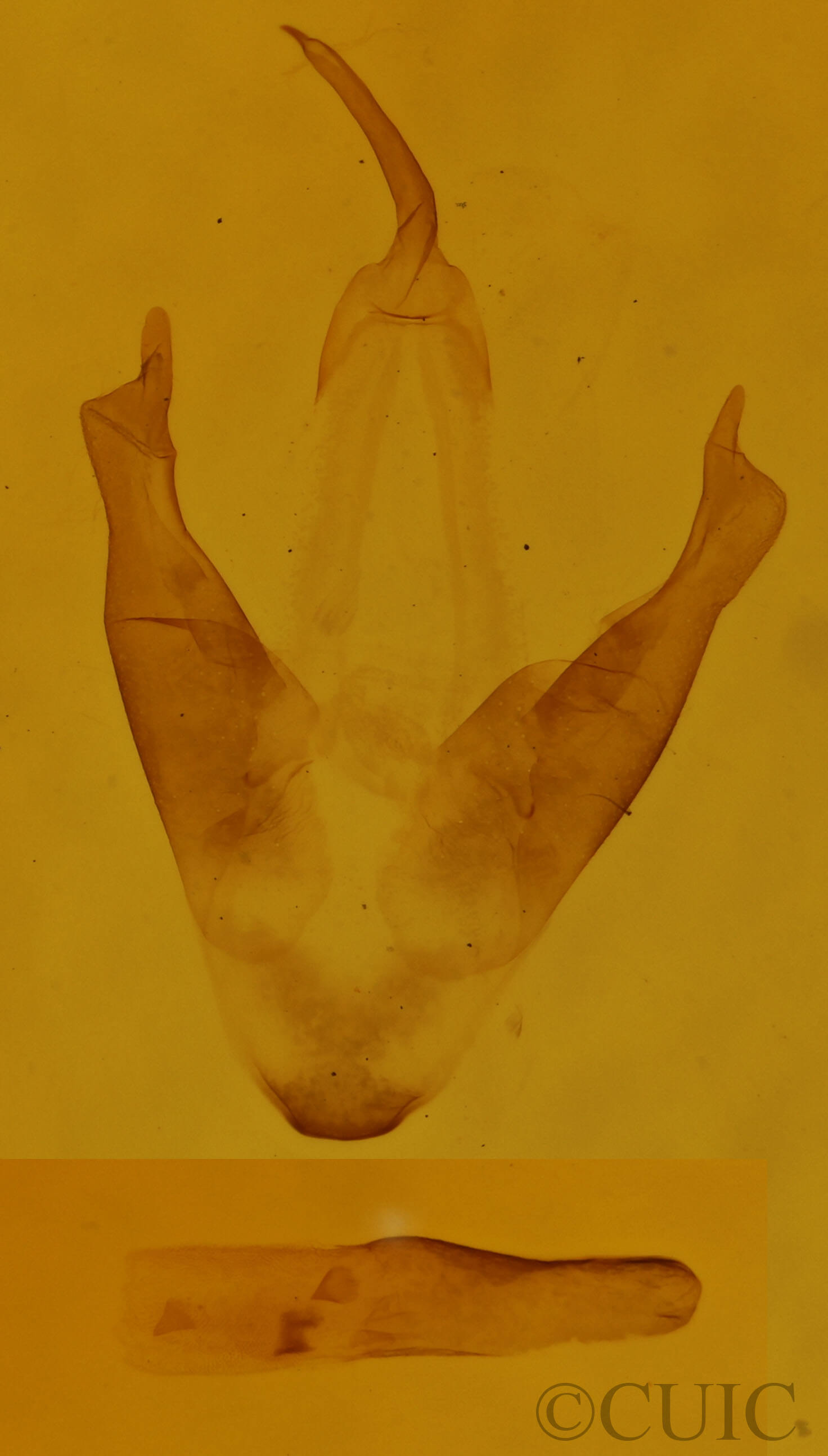 genitalia view of adult Marathyssa basalis