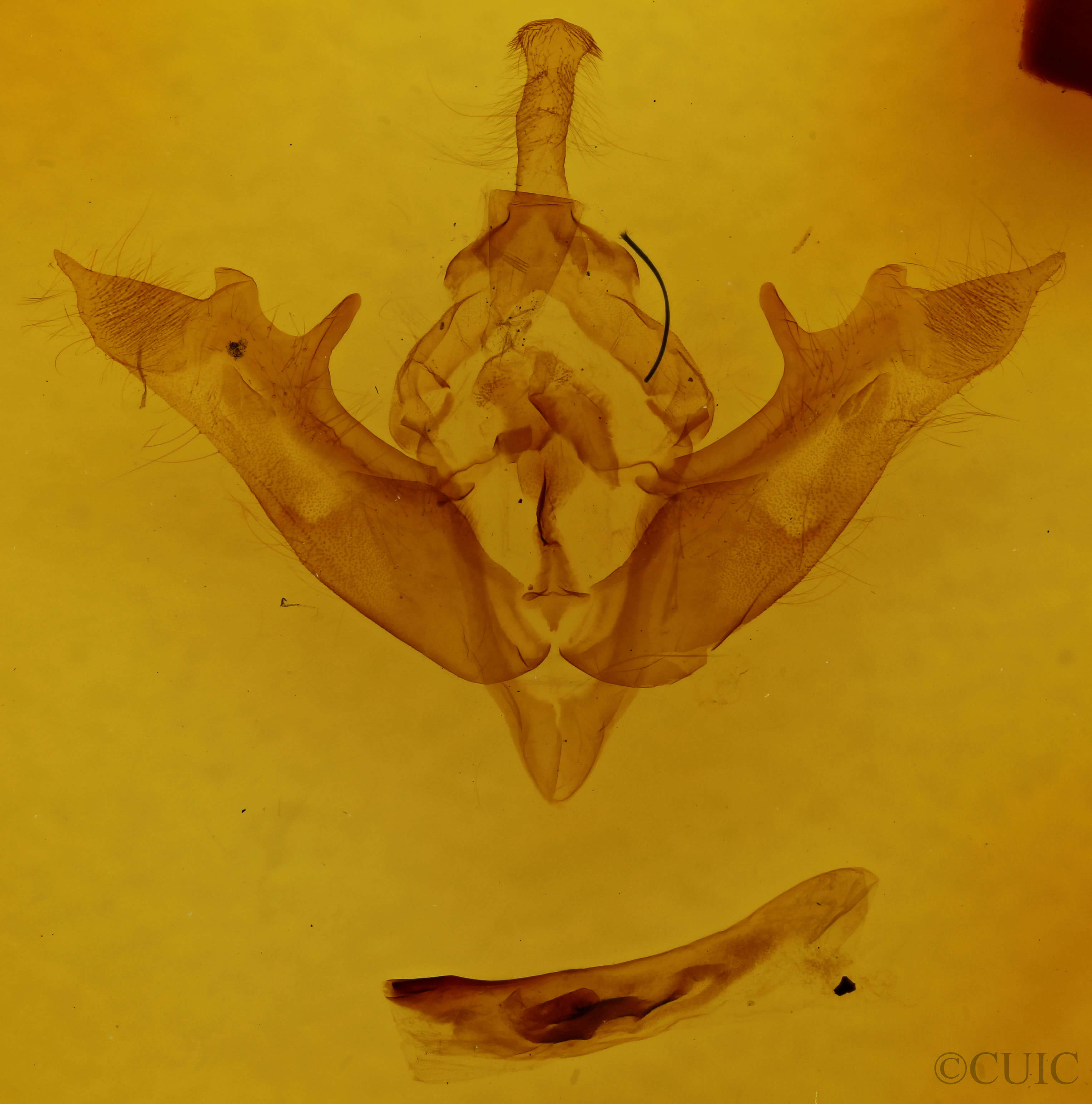 genitalia view of adult Melanchra picta