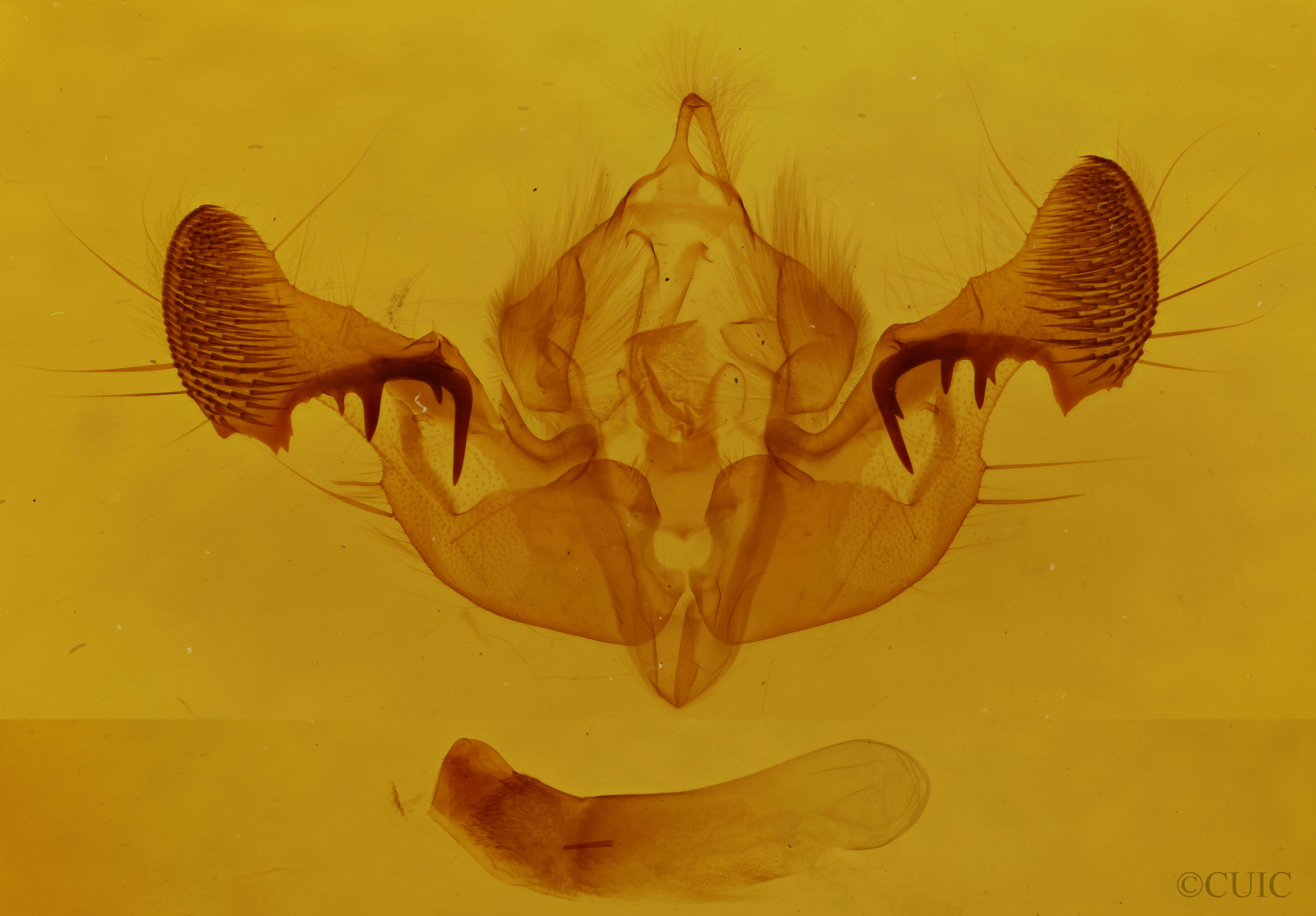 genitalia view of adult Mesapamea fractilinea fractilinea