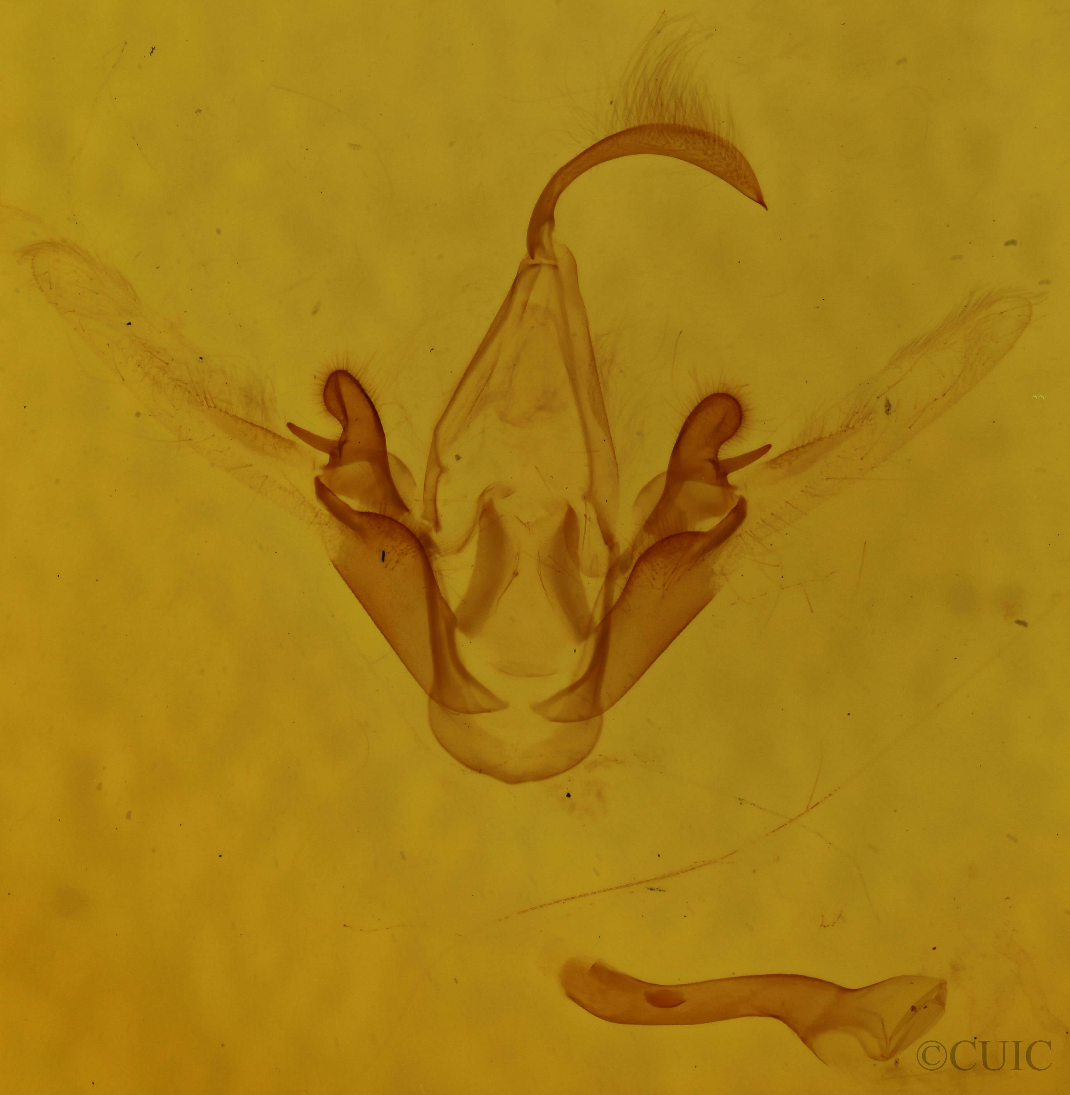 genitalia view of adult Metalectra discalis