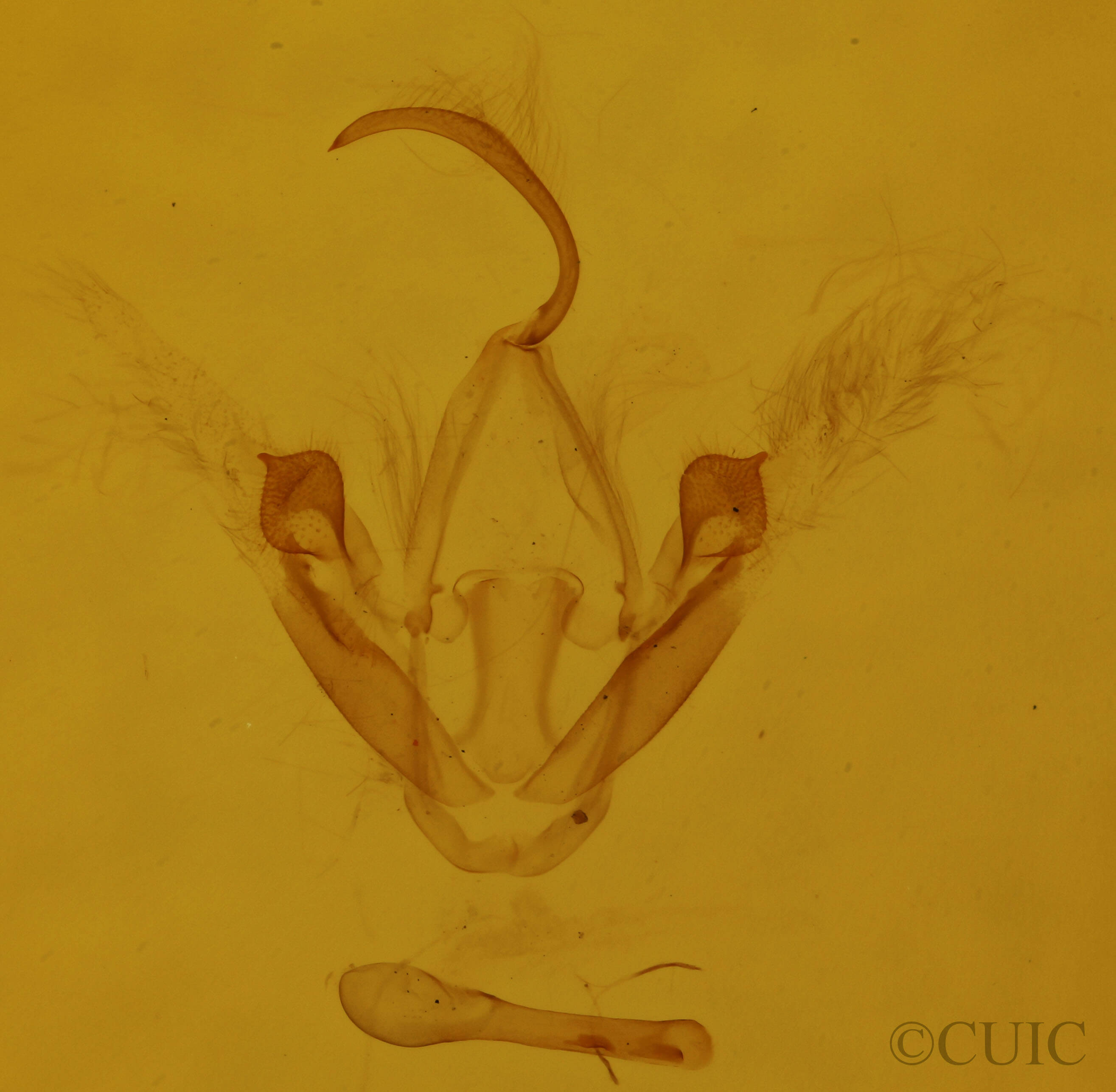 genitalia view of adult Metalectra quadrisignata