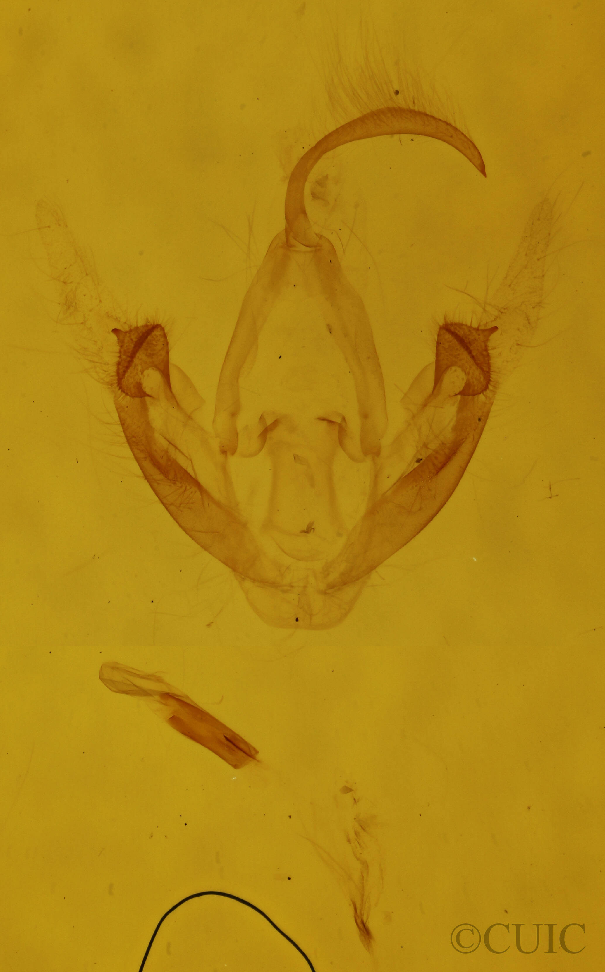 genitalia view of adult Metalectra quadrisignata