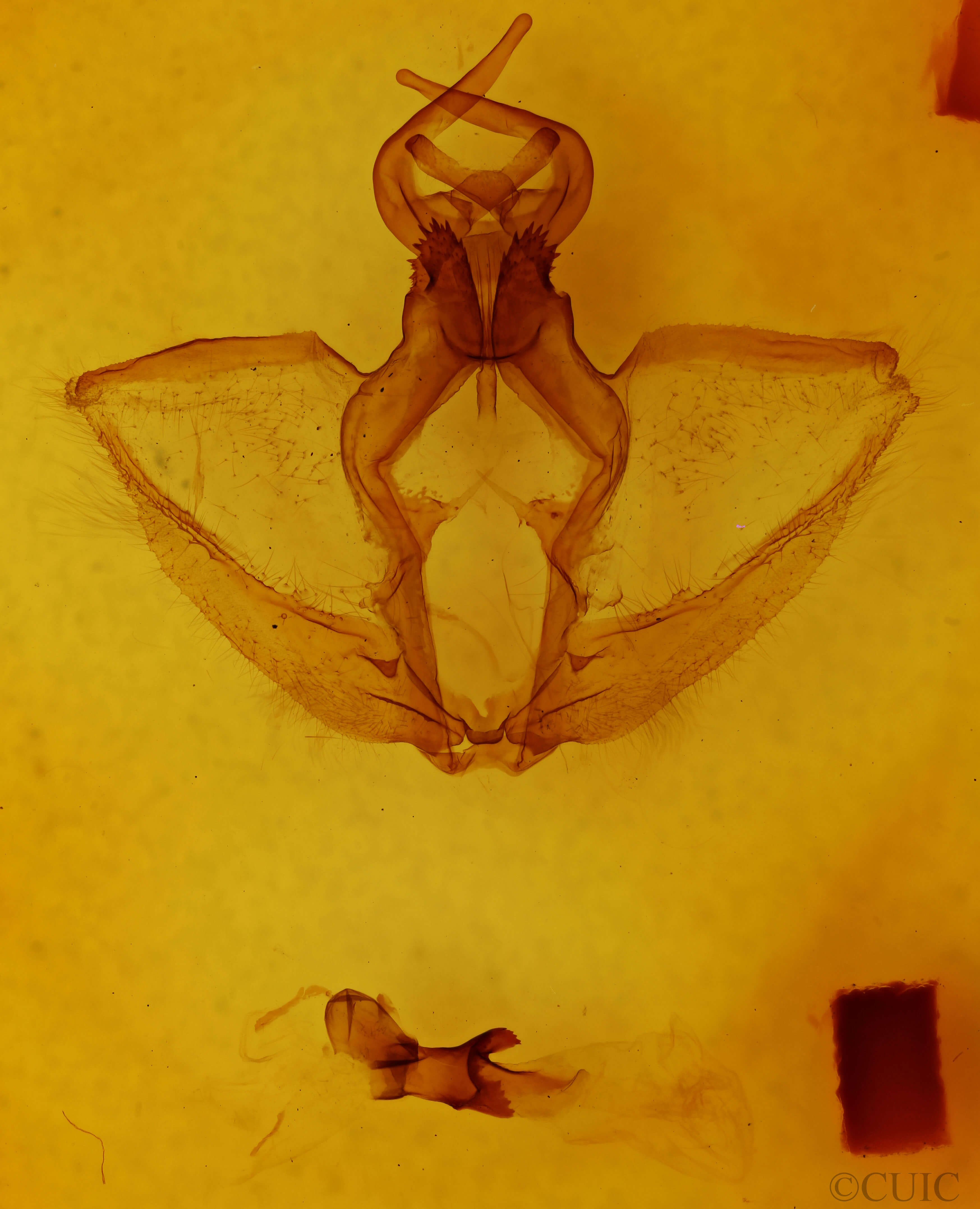 genitalia view of adult Navarcostes limnatis