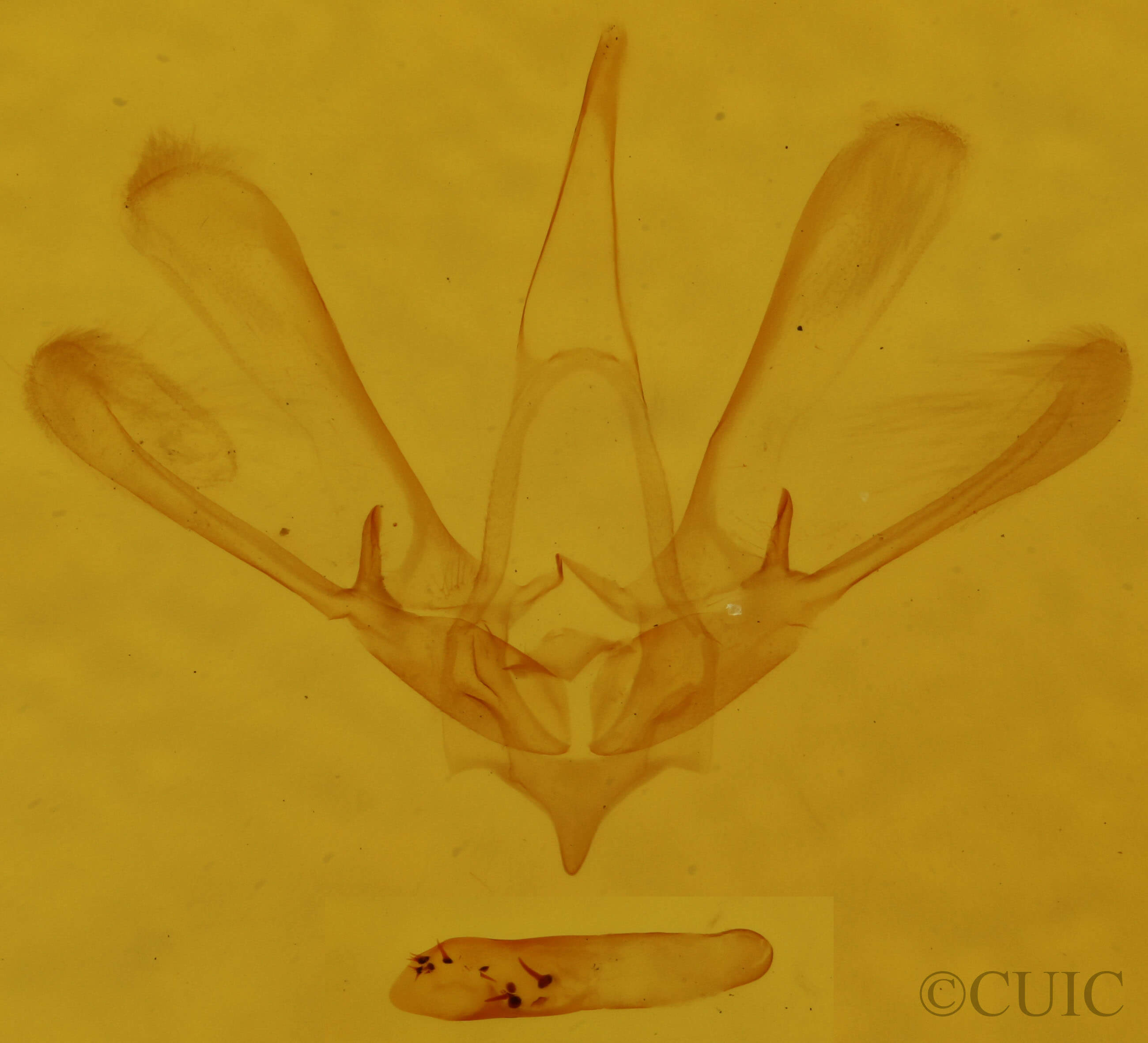 genitalia view of adult Nola triquetrana