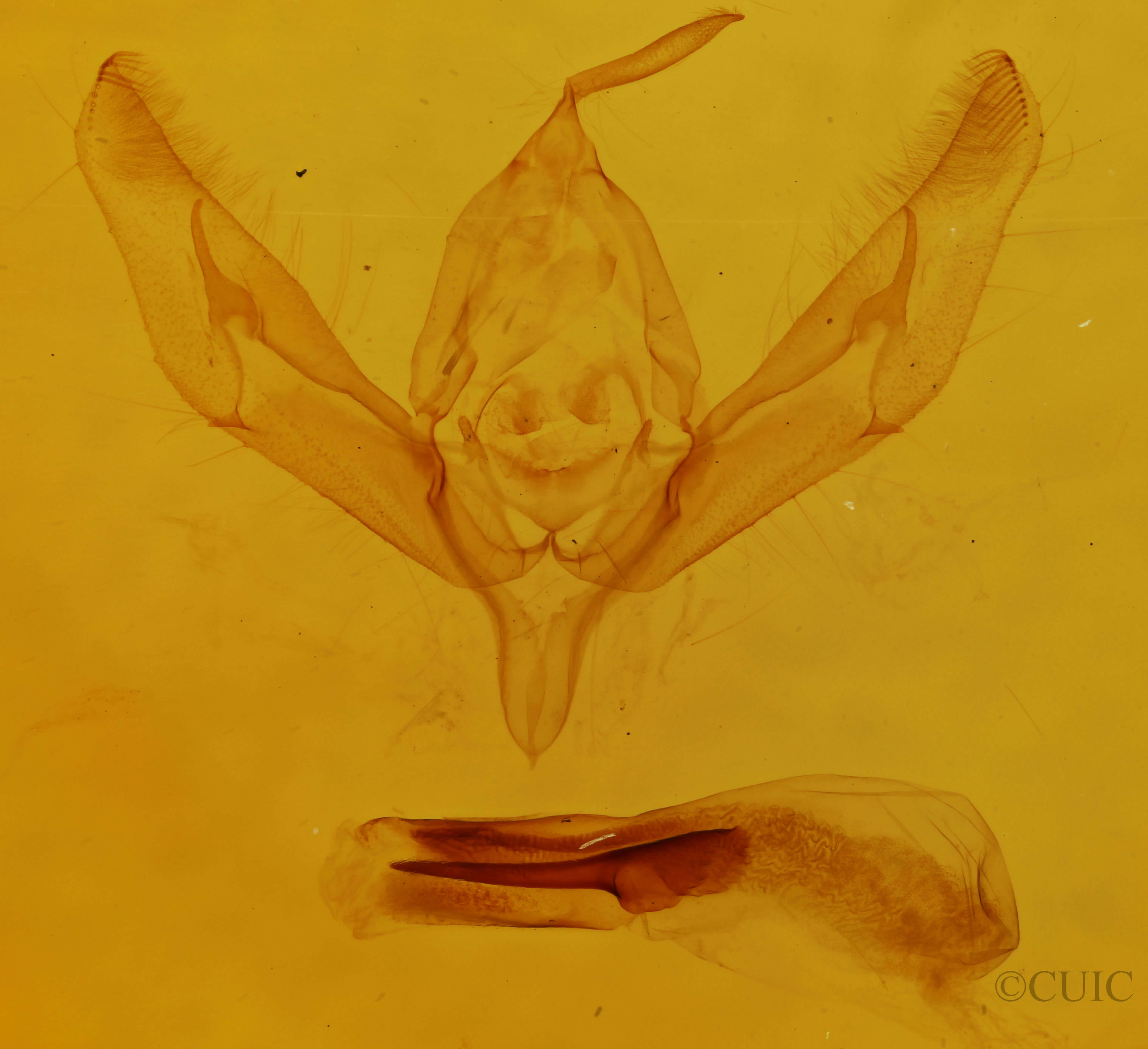 genitalia view of adult Ochropleura implecta