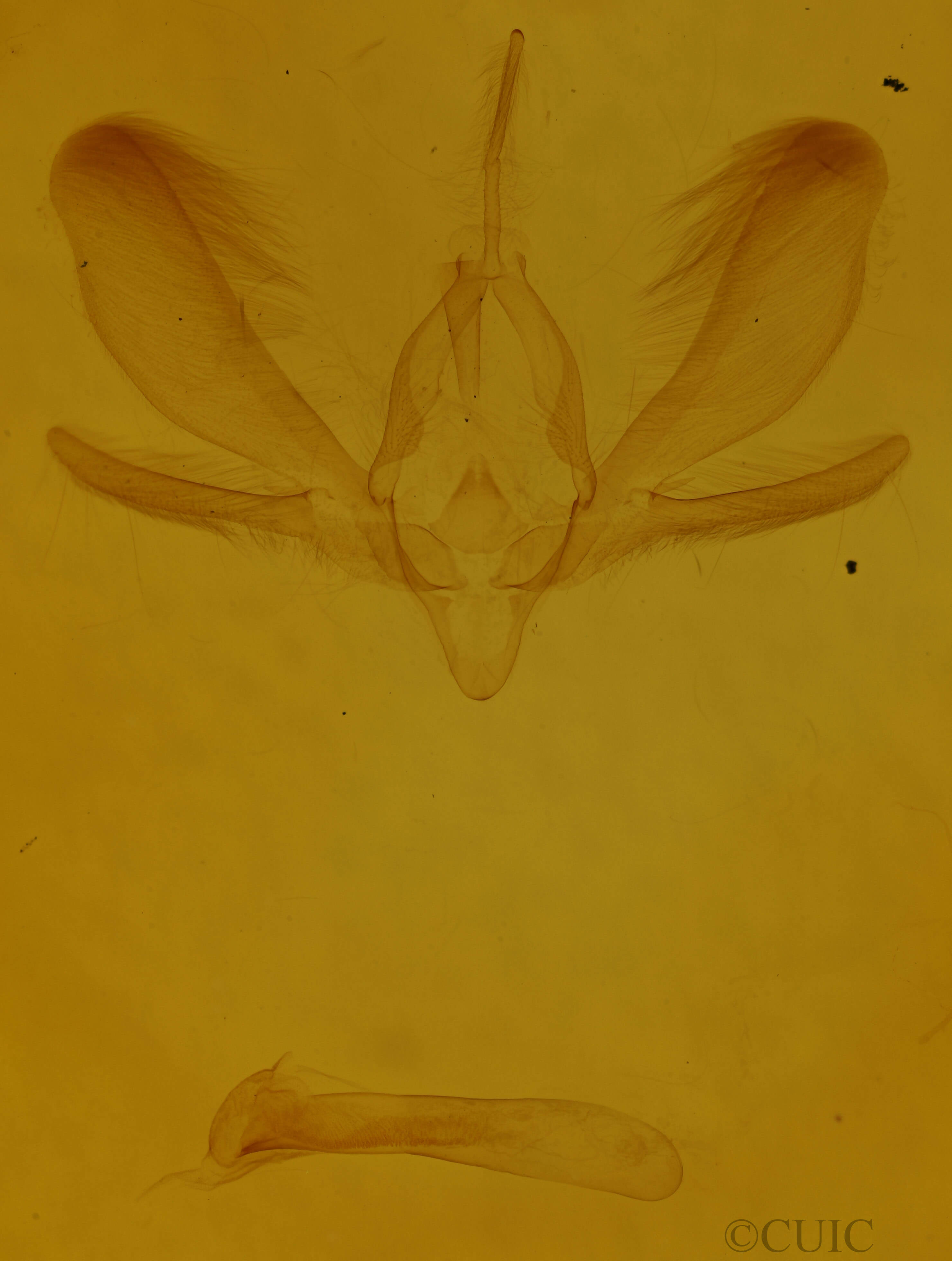 genitalia view of adult Ogdoconta cinereola