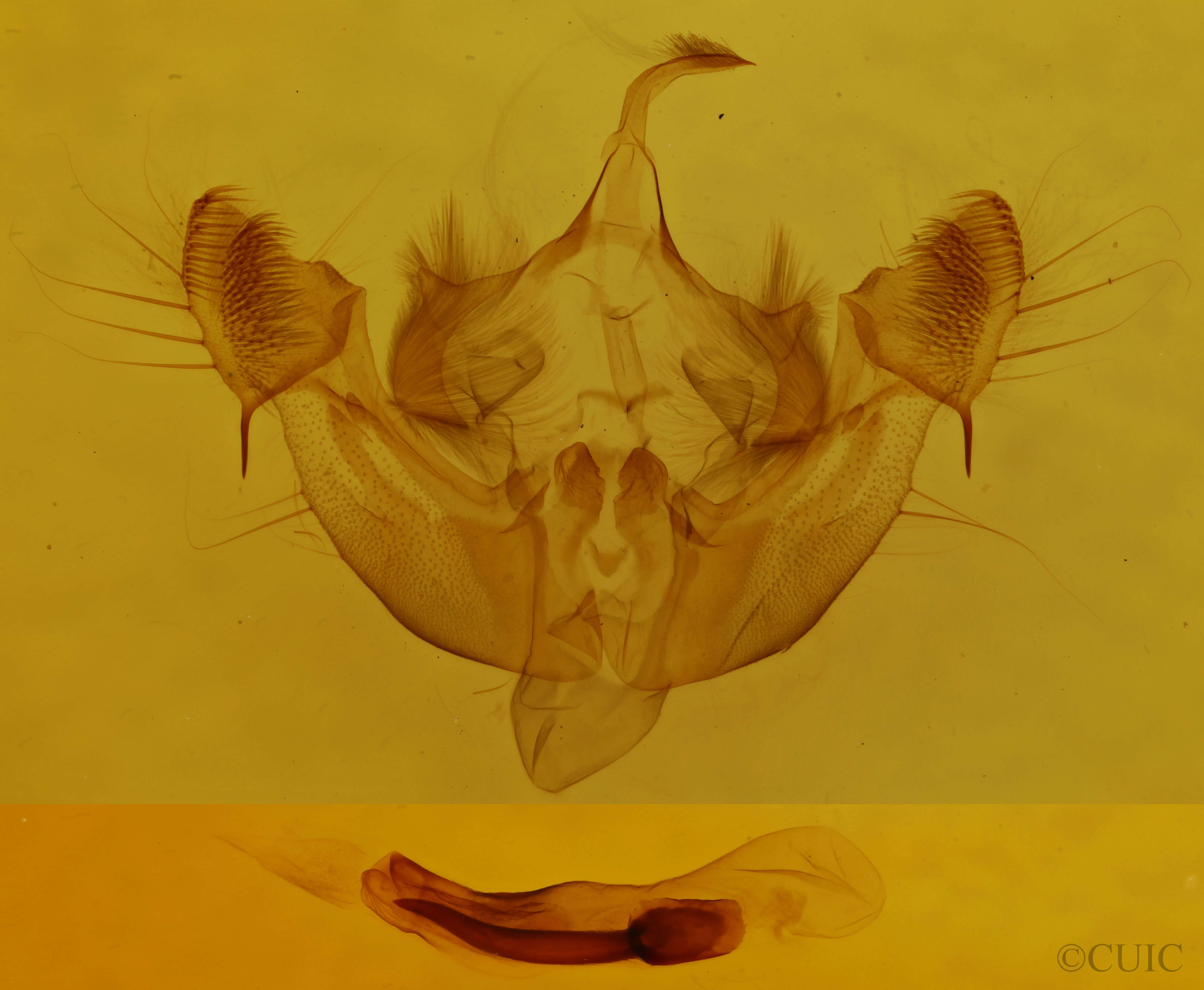 genitalia view of adult Oligia modica