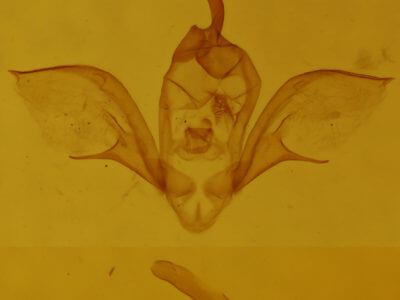 genitalia view of adult Costaconvexa centrostrigaria