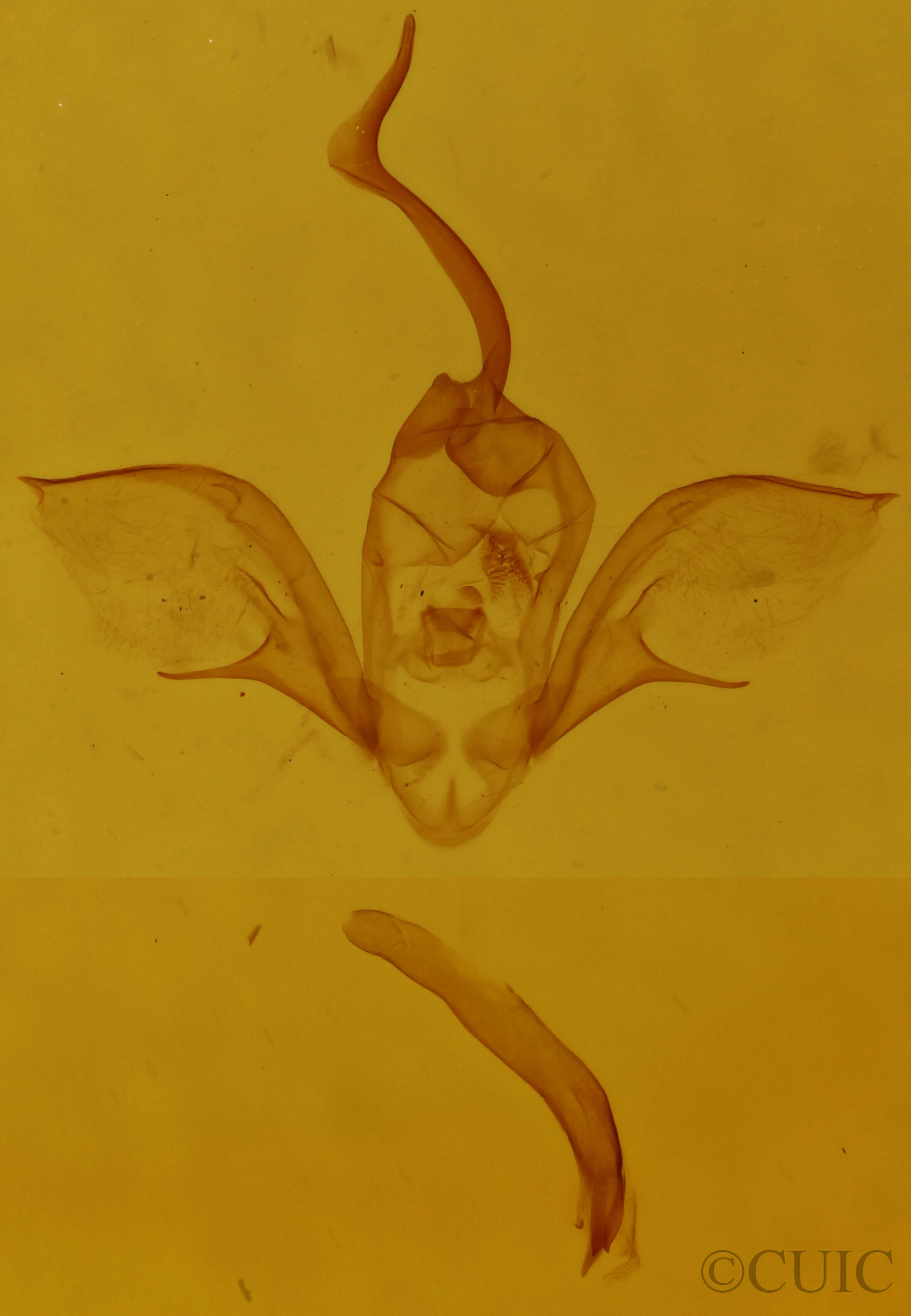 genitalia view of adult Costaconvexa centrostrigaria