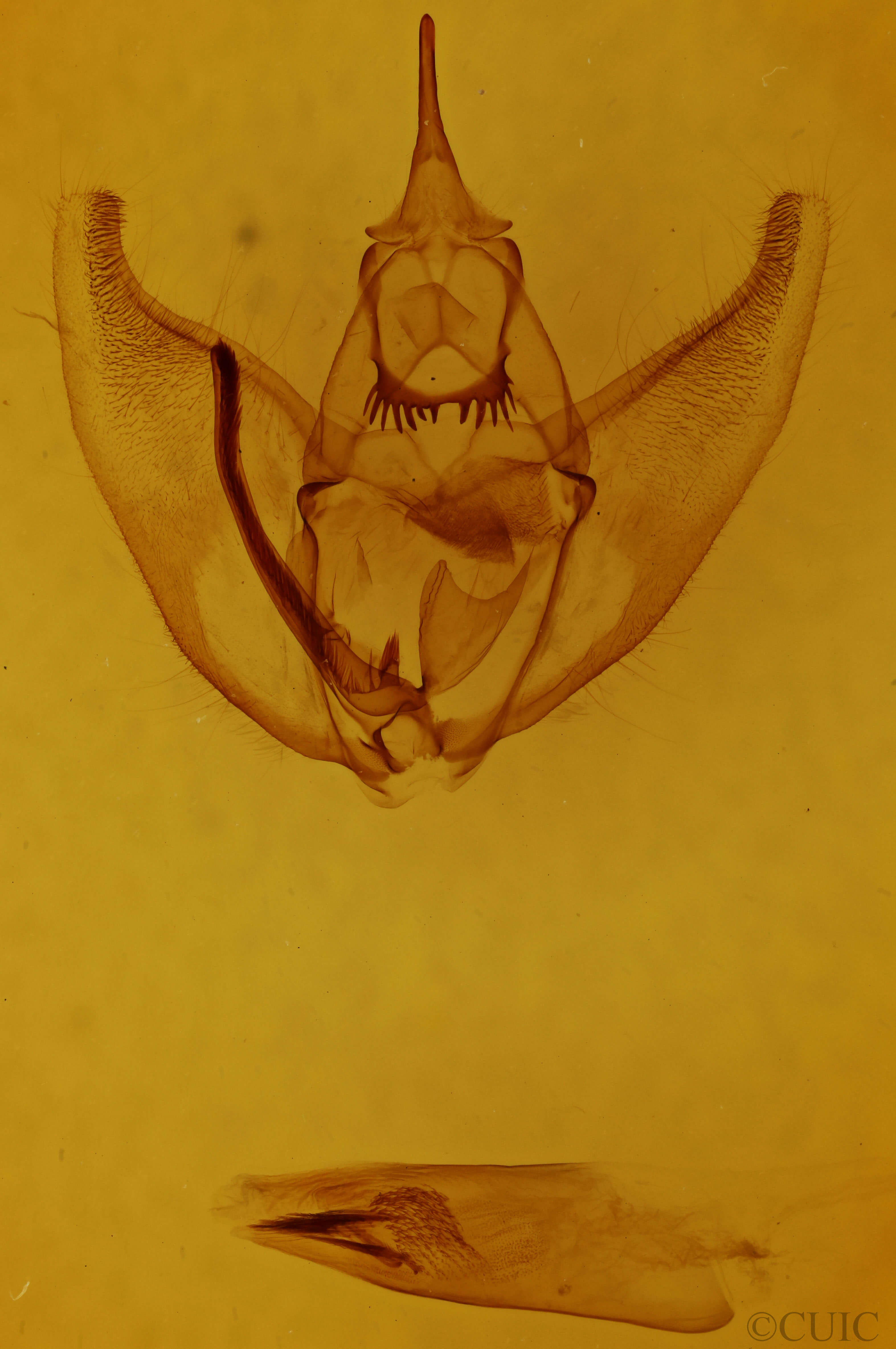 genitalia view of Oxydia platypterata