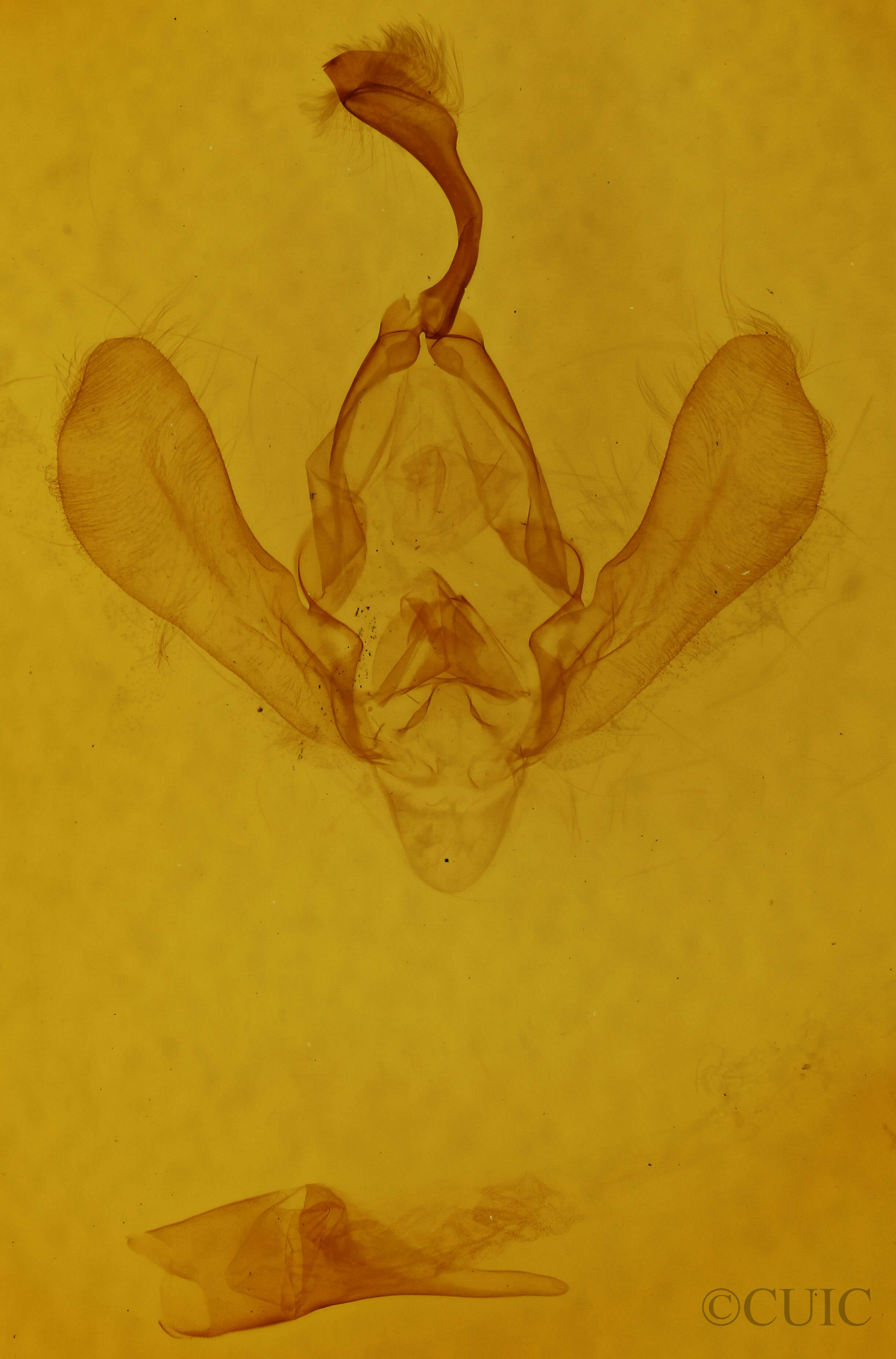genitalia view of adult Panopoda carneicosta