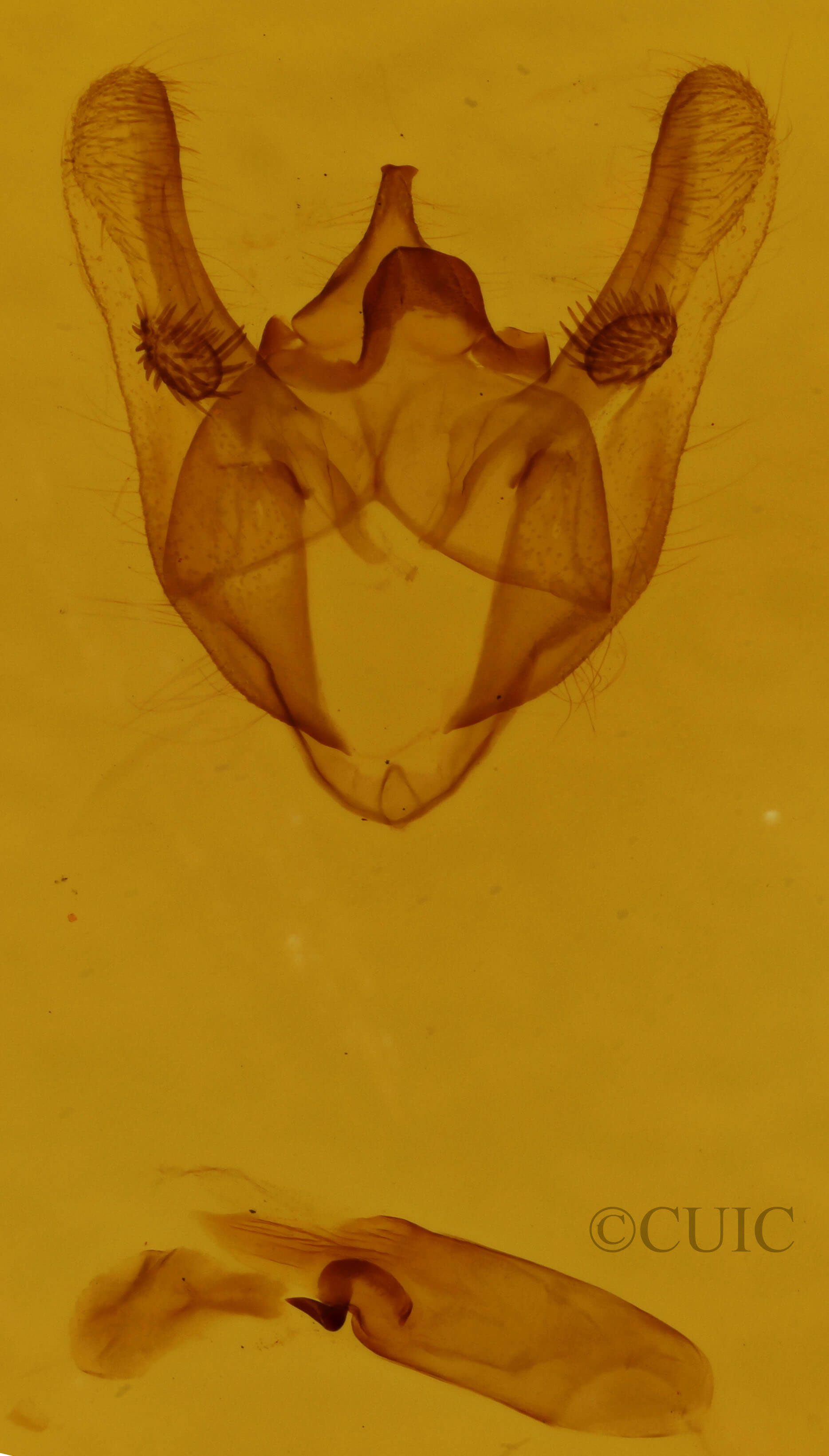 genitalia view of adult Phigalia titea