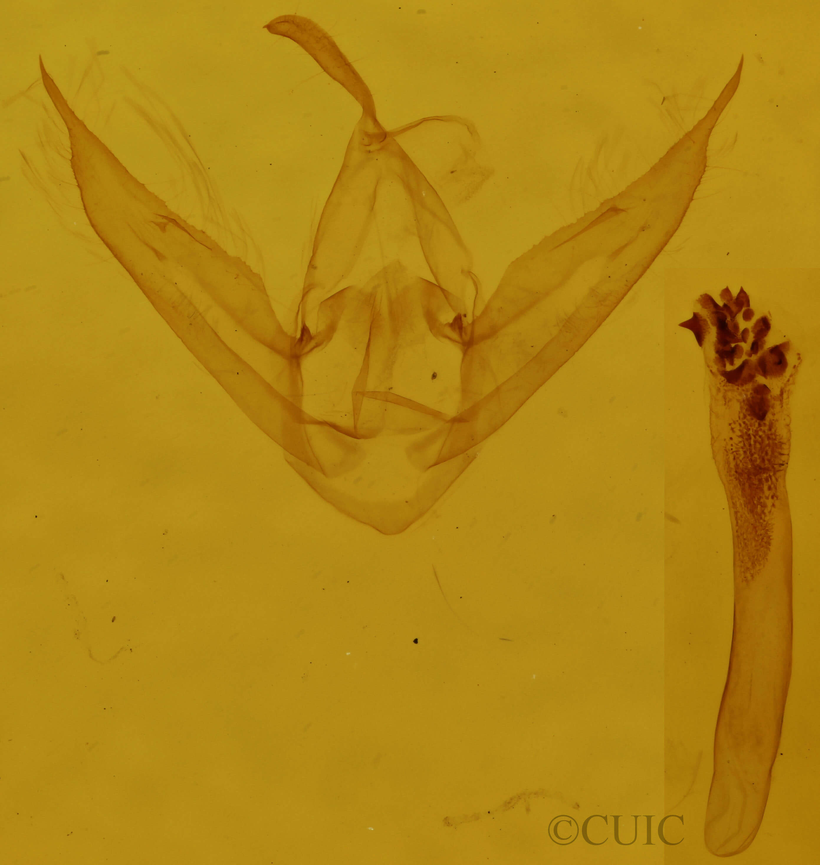 genitalia view of adult Phalaenostola metonalis