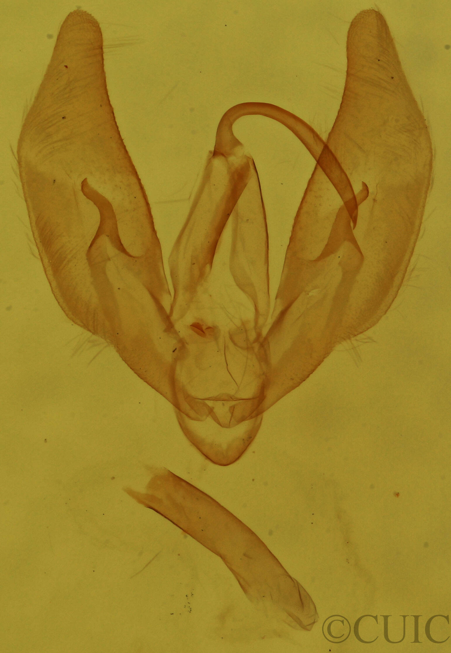 genitalia view of adult Phytometra rhodarialis