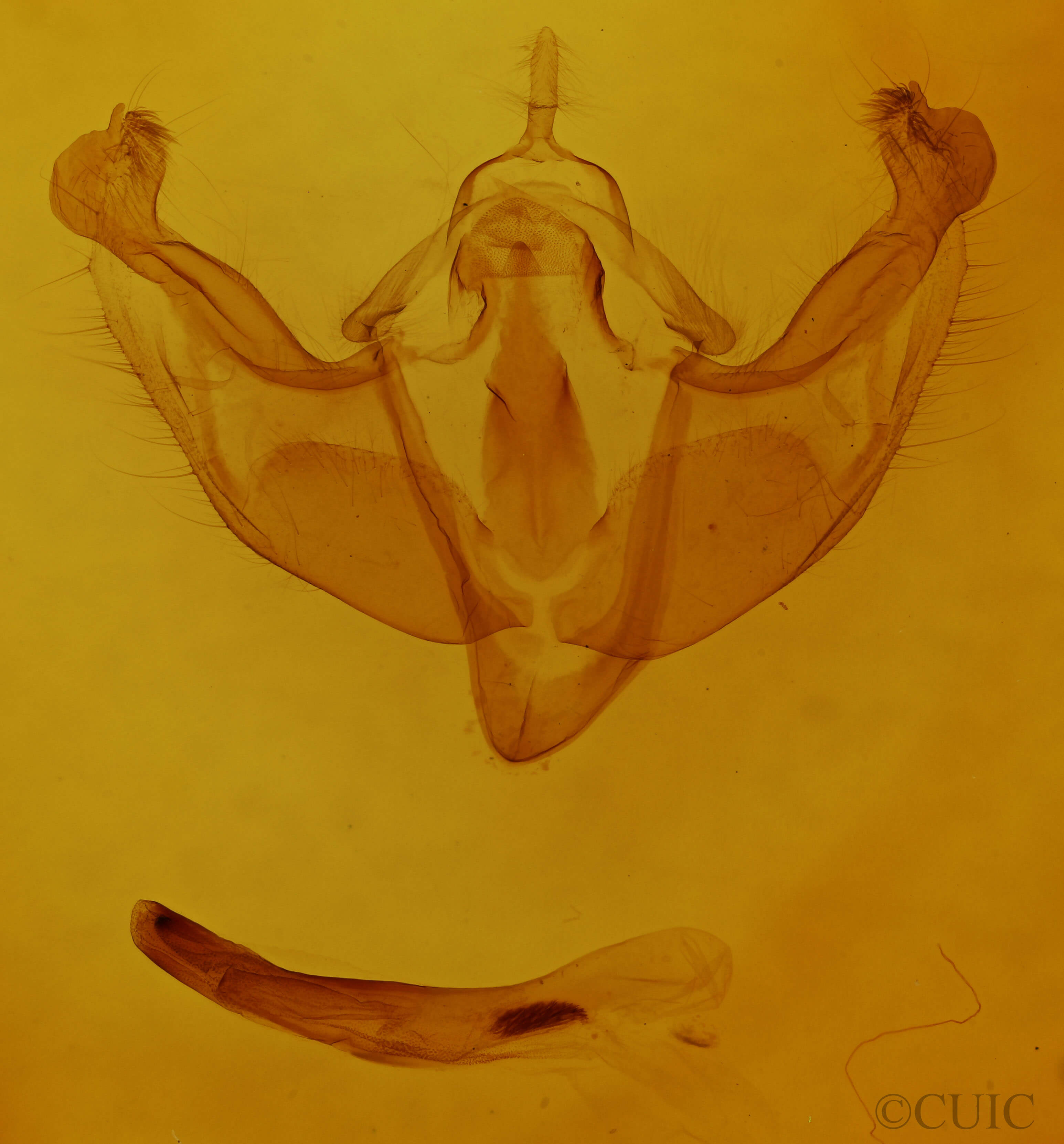 genitalia view of adult Platypolia anceps
