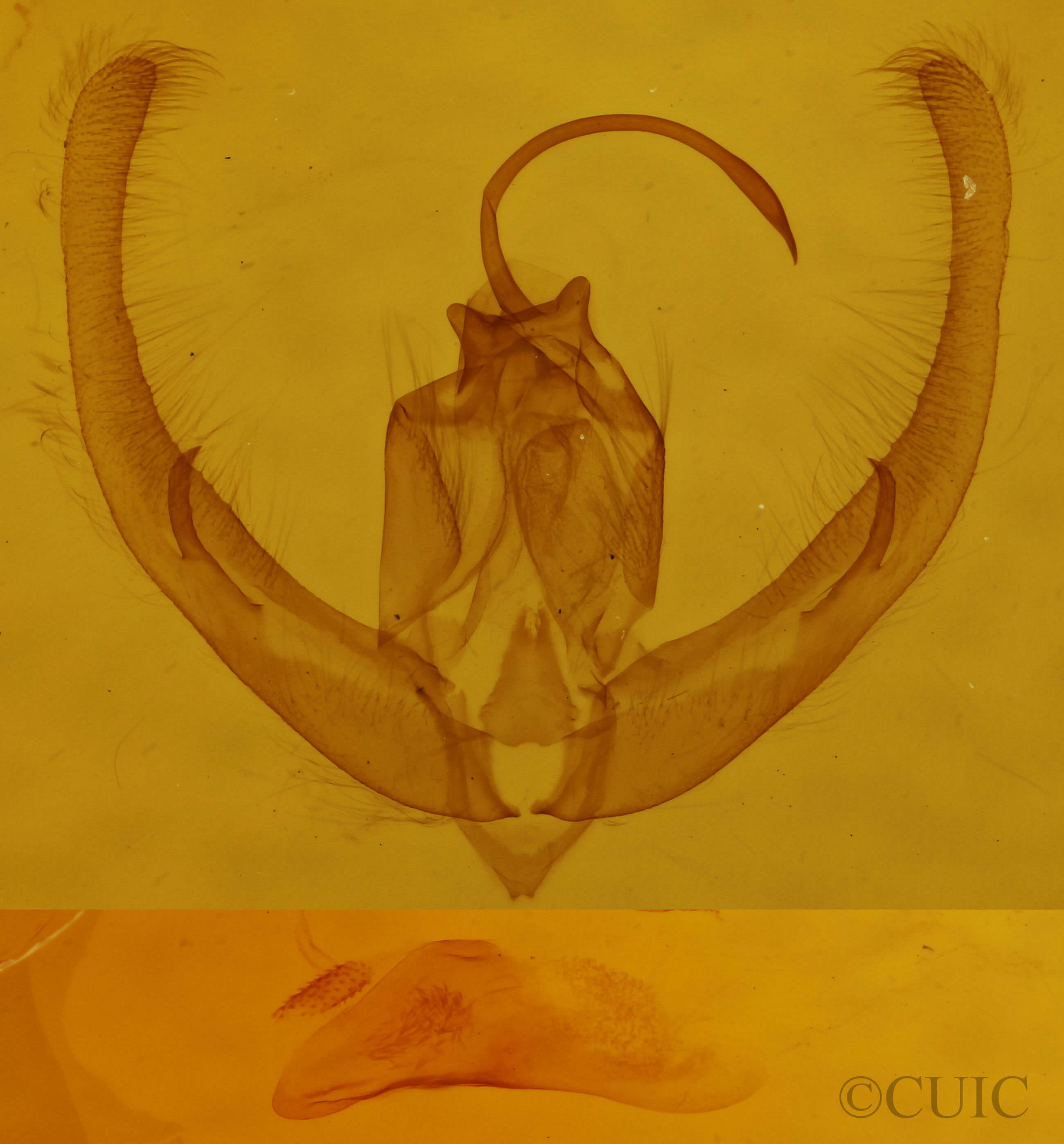 genitalia view of adult Condica videns