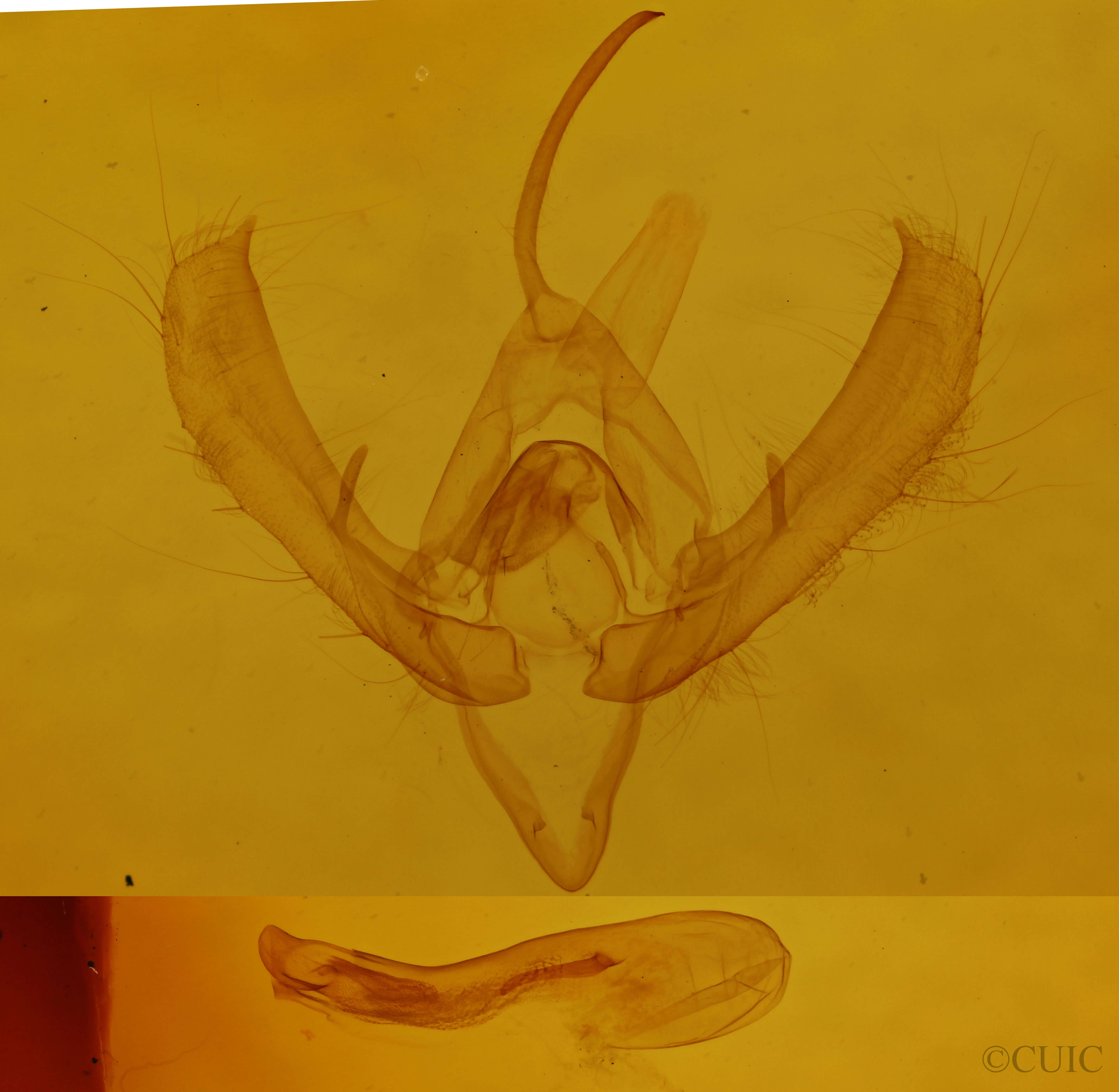 genitalia view of adult Plusia contexta