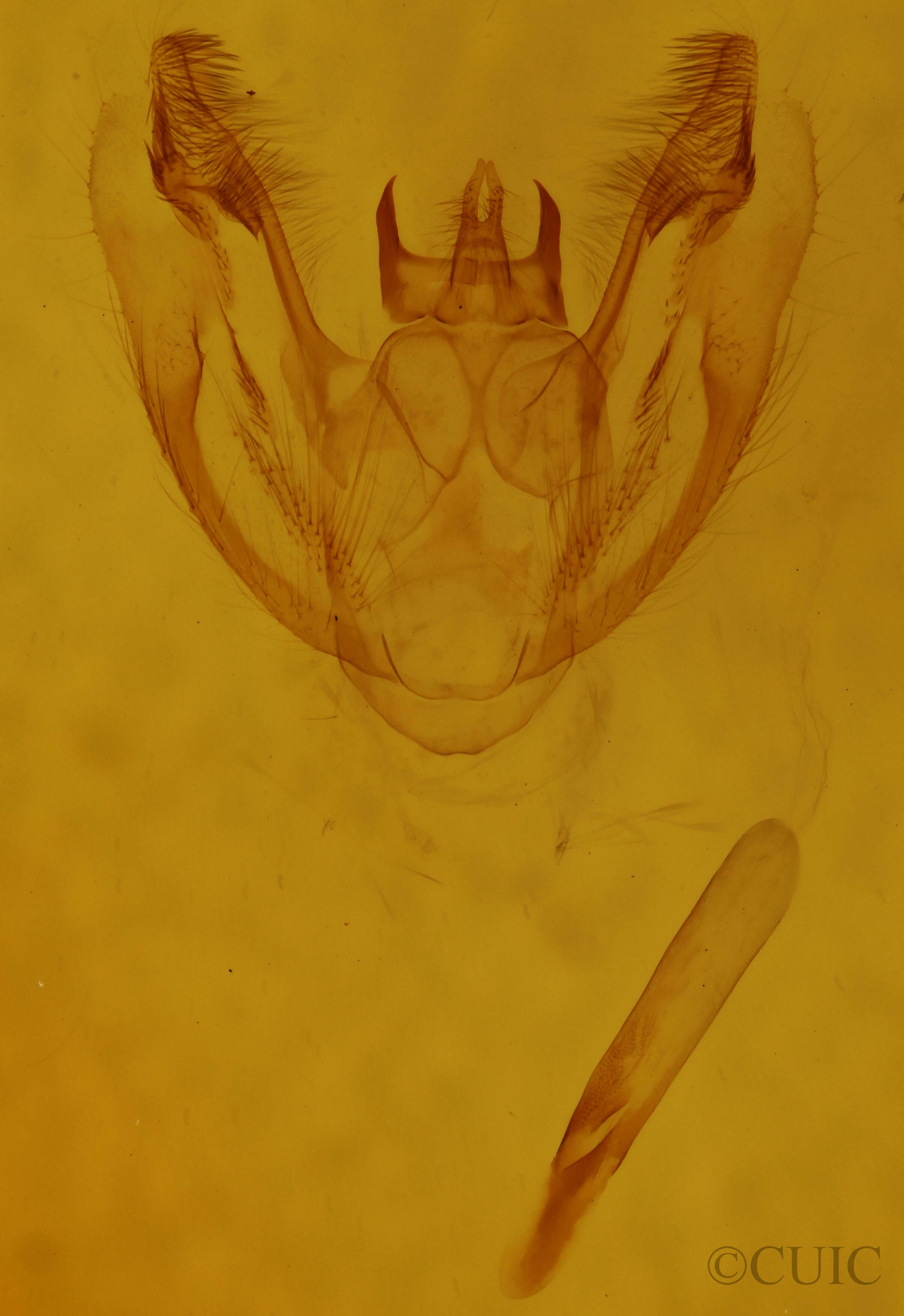genitalia view of adult Protoboarmia porcelaria