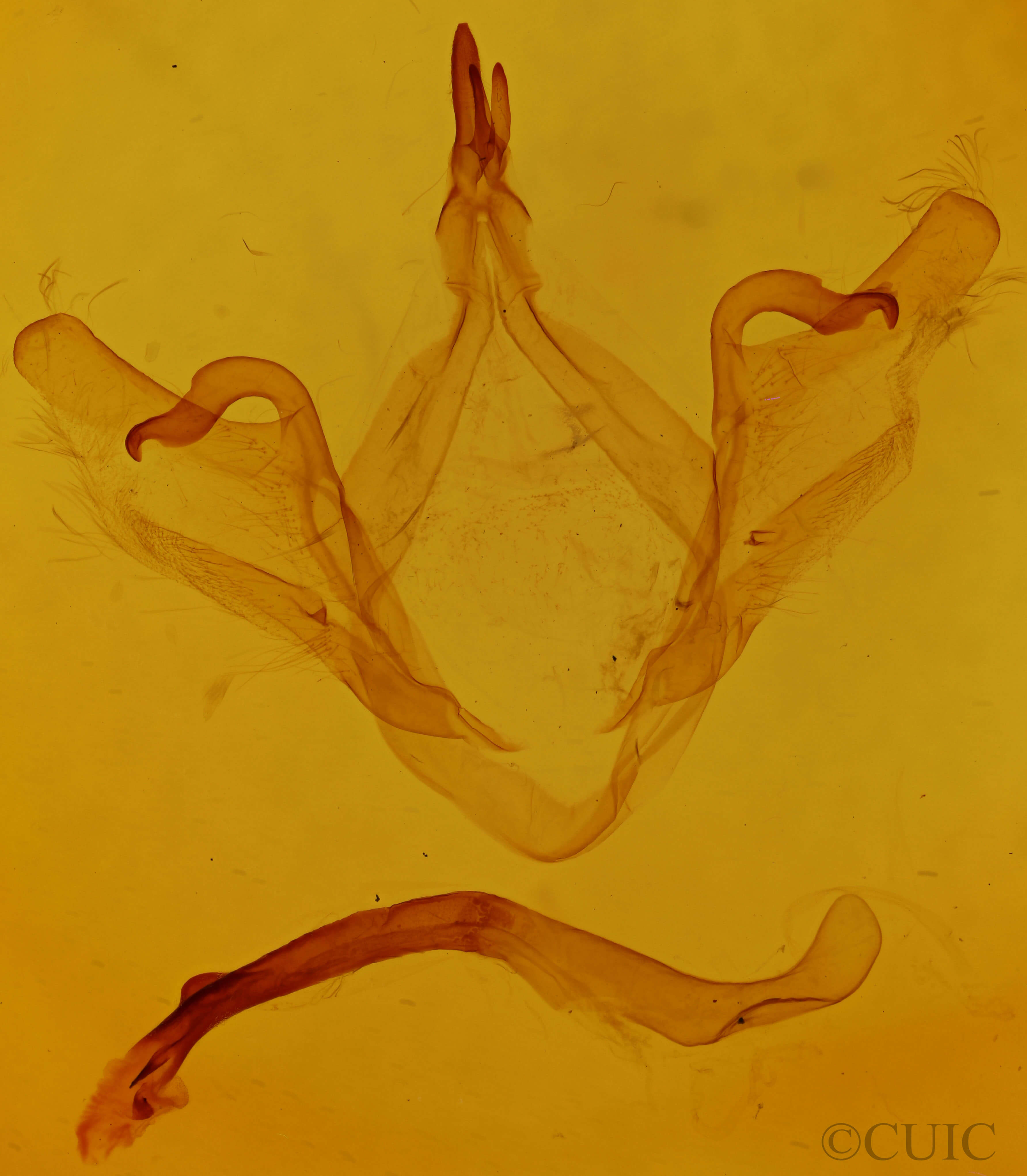 genitalia view of adult Oedemasia leptinoides