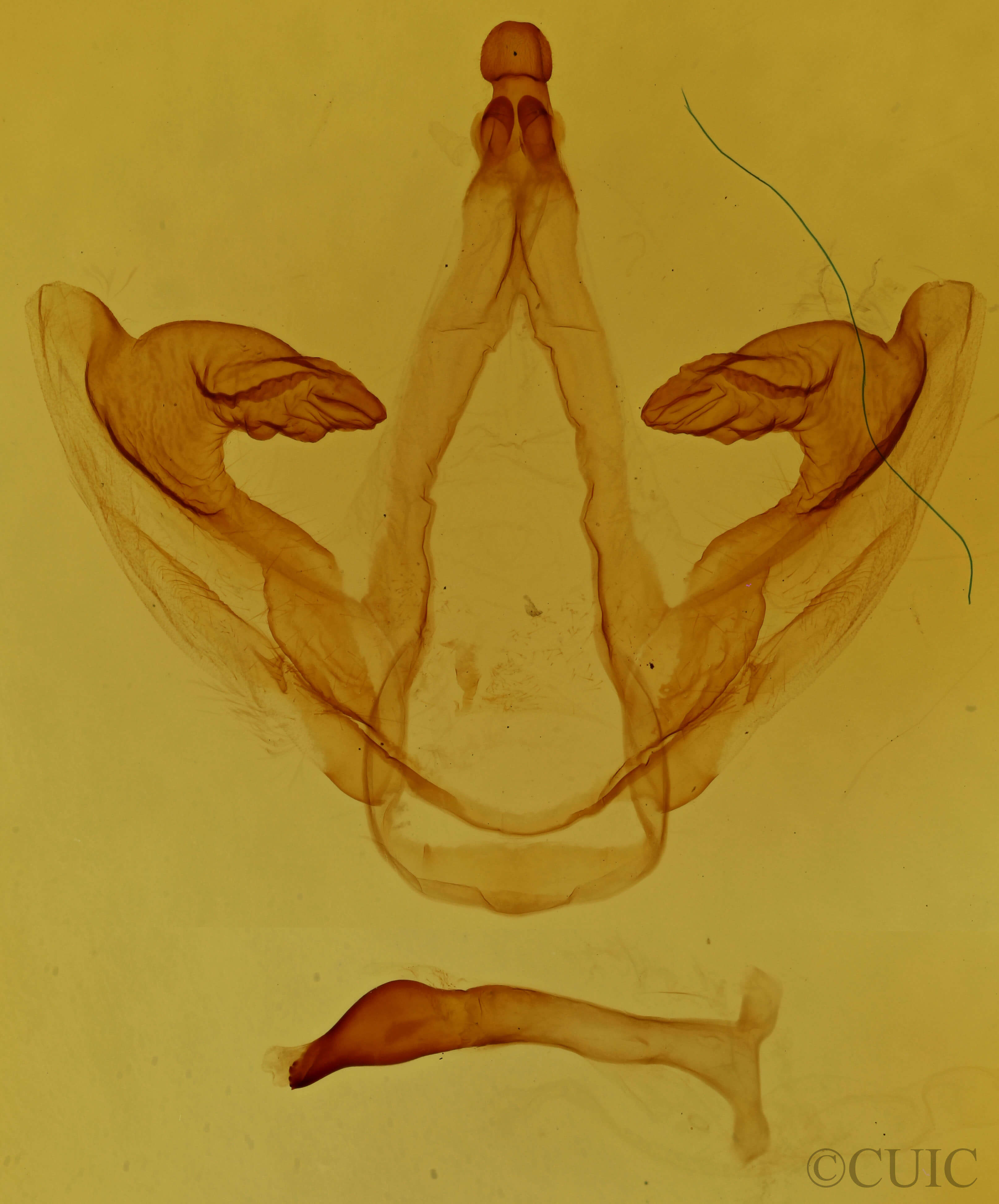 genitalia view of adult Oedemasia semirufescens