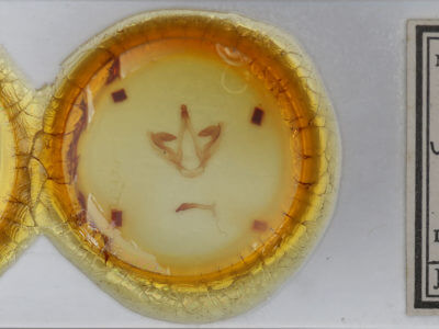 slide view of adult Oedemasia semirufescens