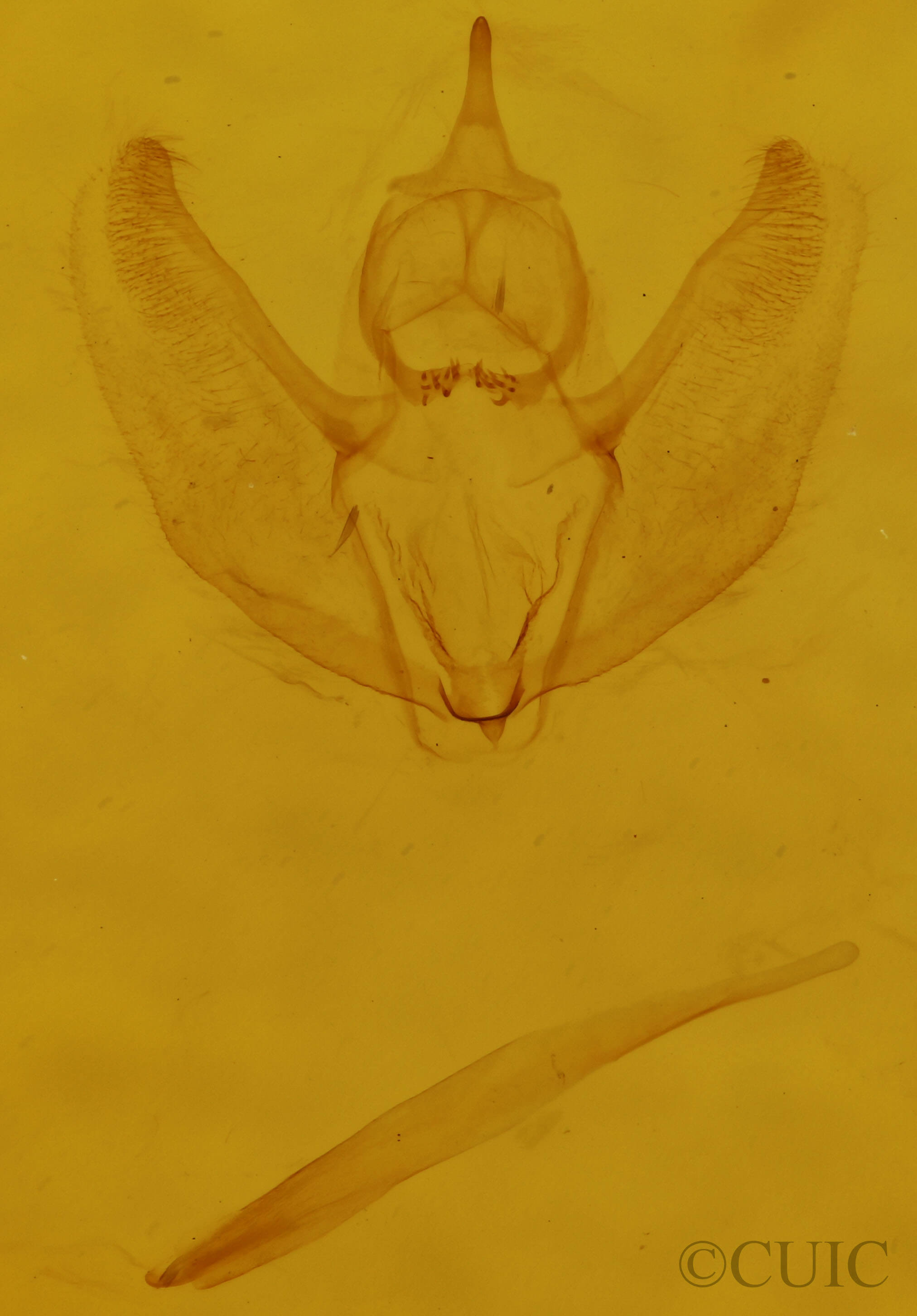 genitalia view of adult Sicya macularia