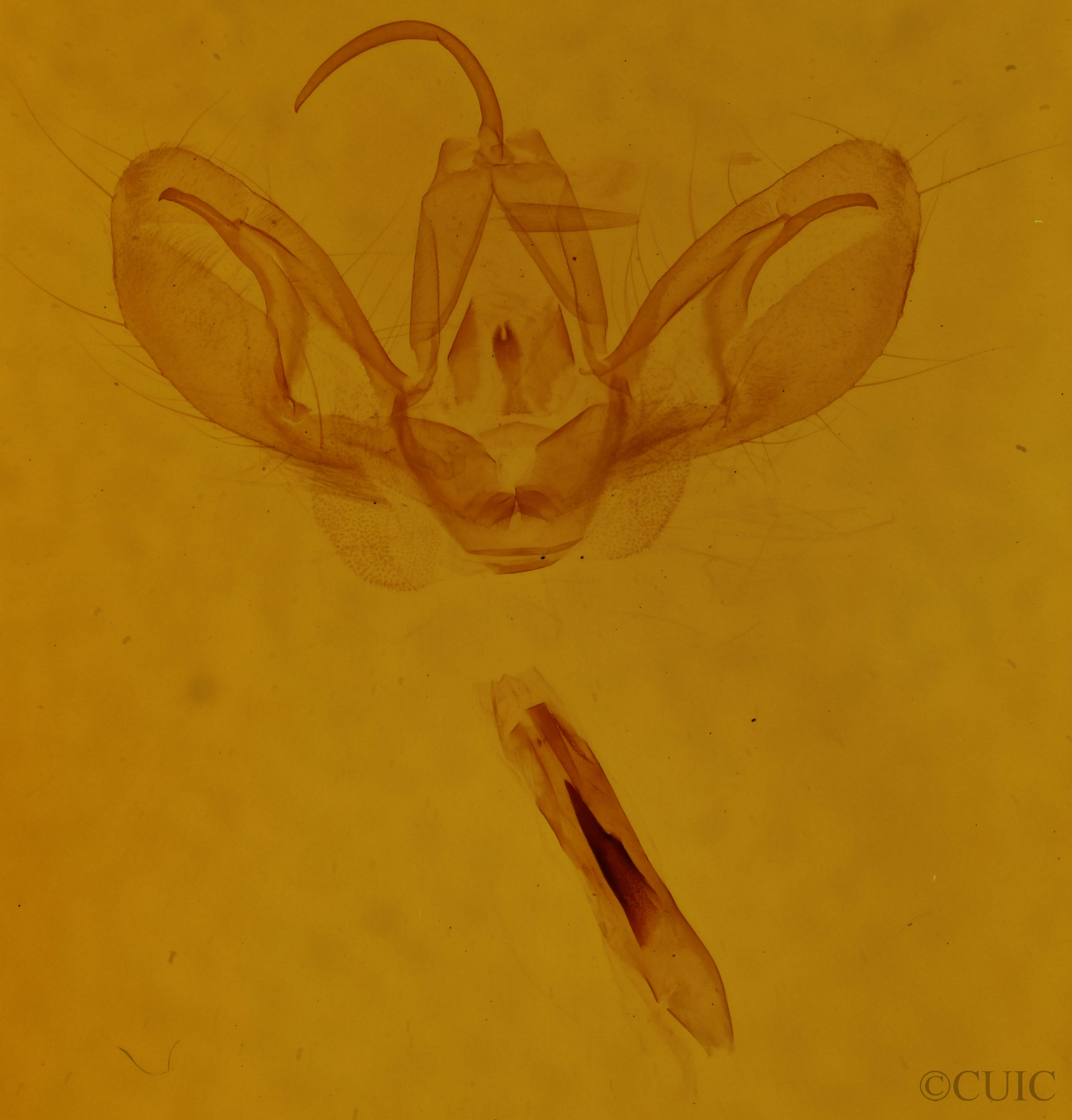 genitalia view of adult Spodoptera exigua