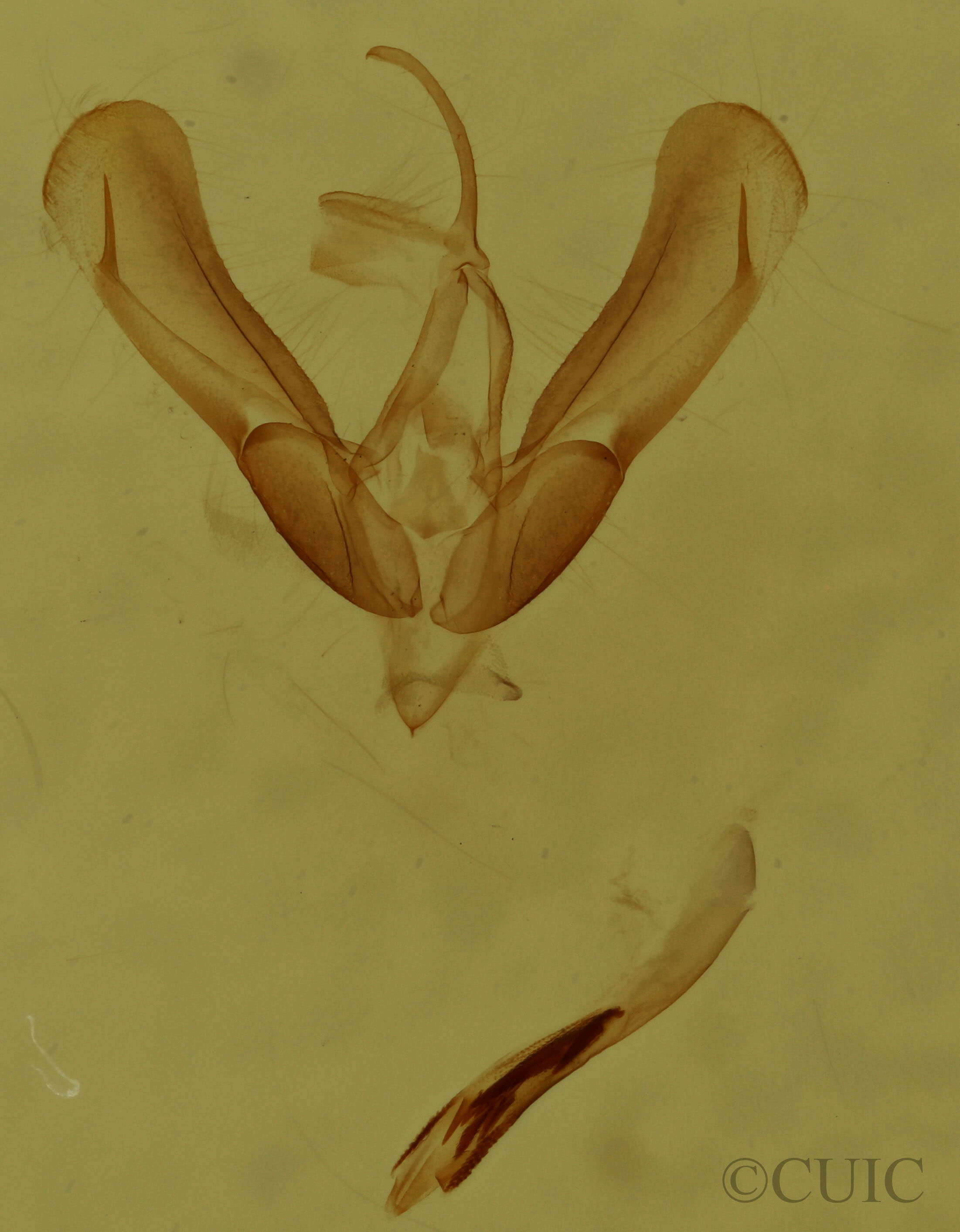 genitalia view of adult Ponometia candefacta
