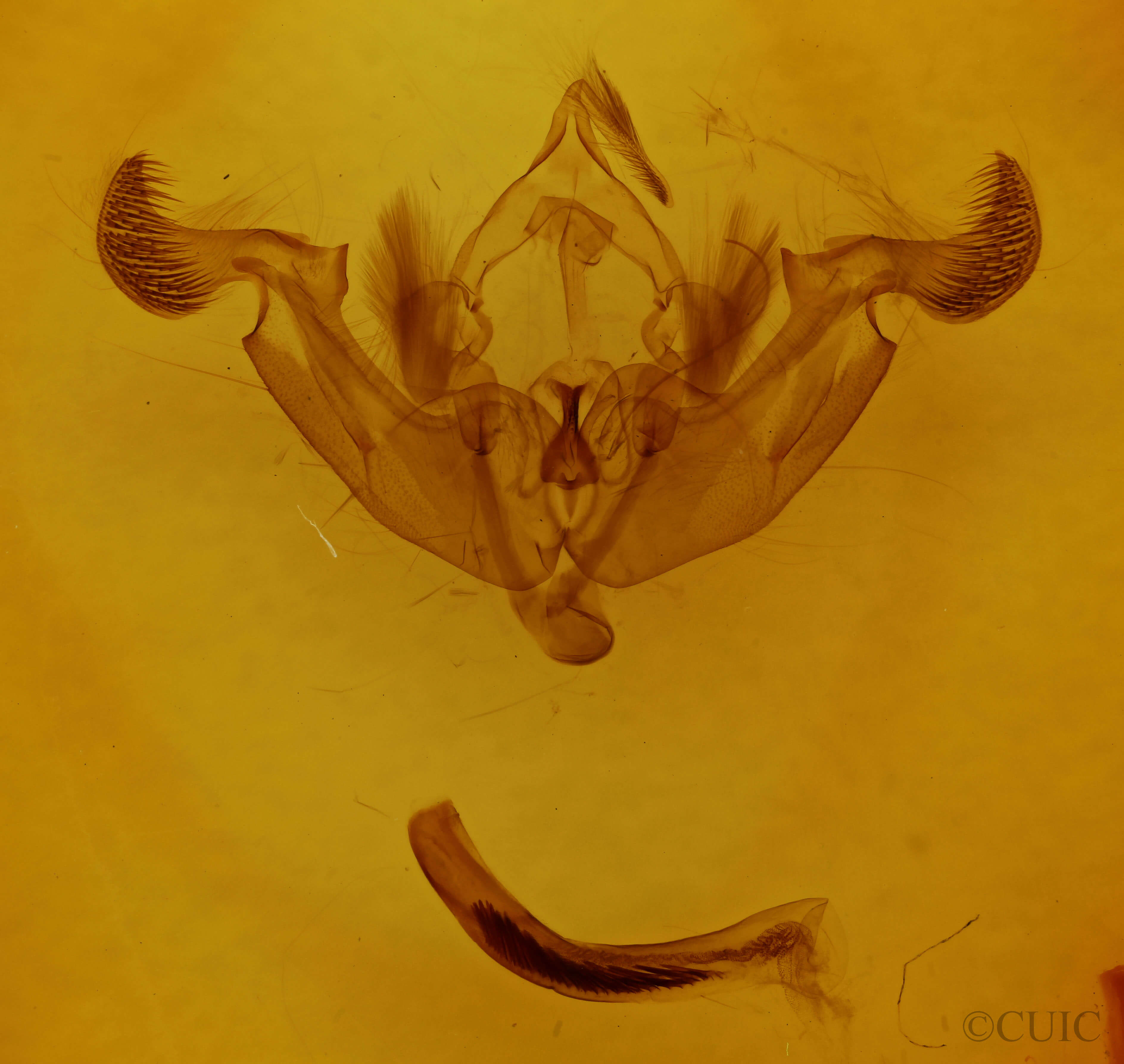 genitalia view of adult Trichordestra legitima