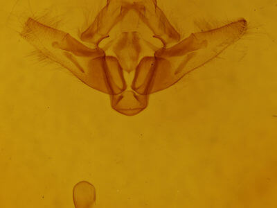 genitalia view of adult Ulochlaena hirta