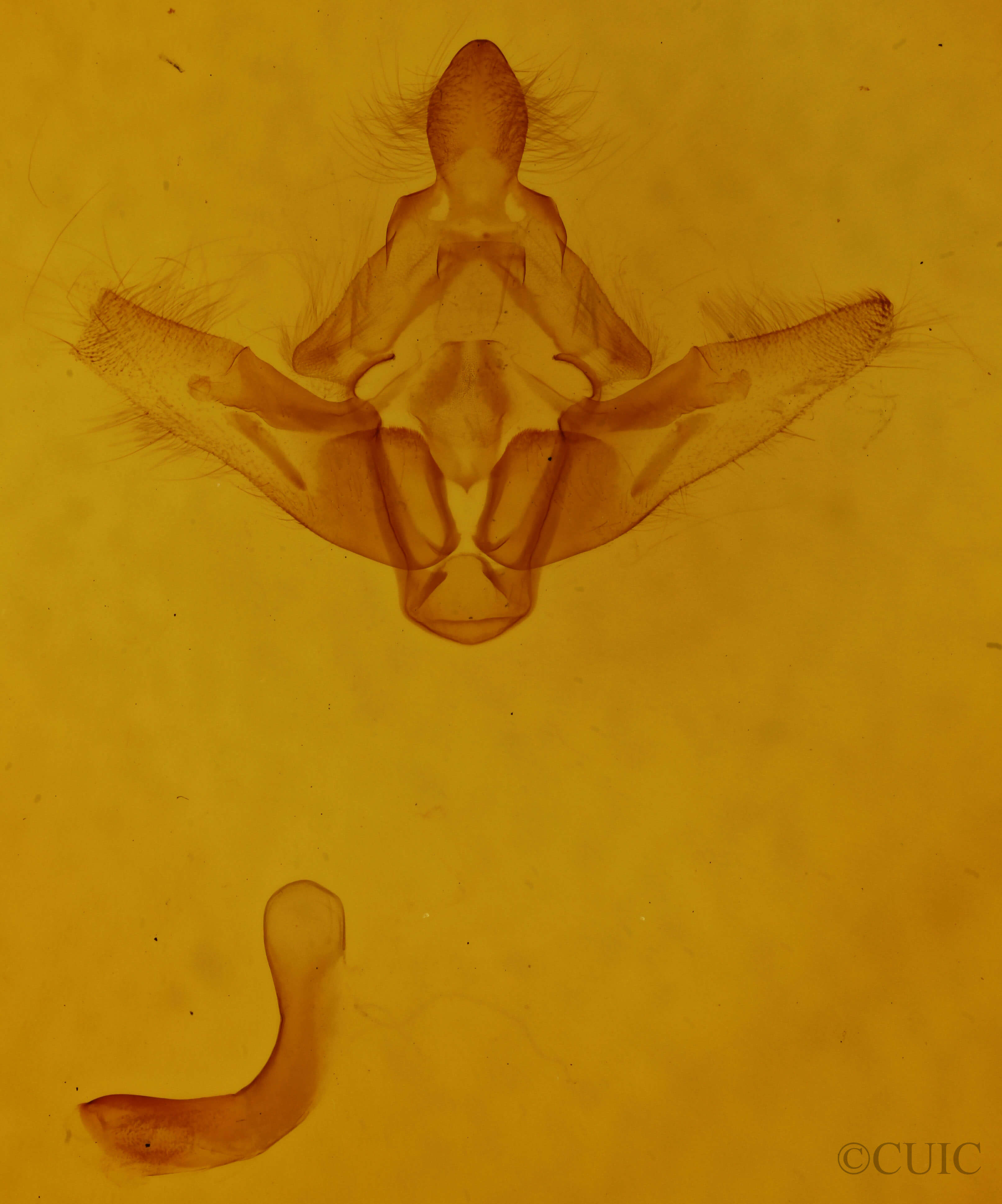 genitalia view of adult Ulochlaena hirta