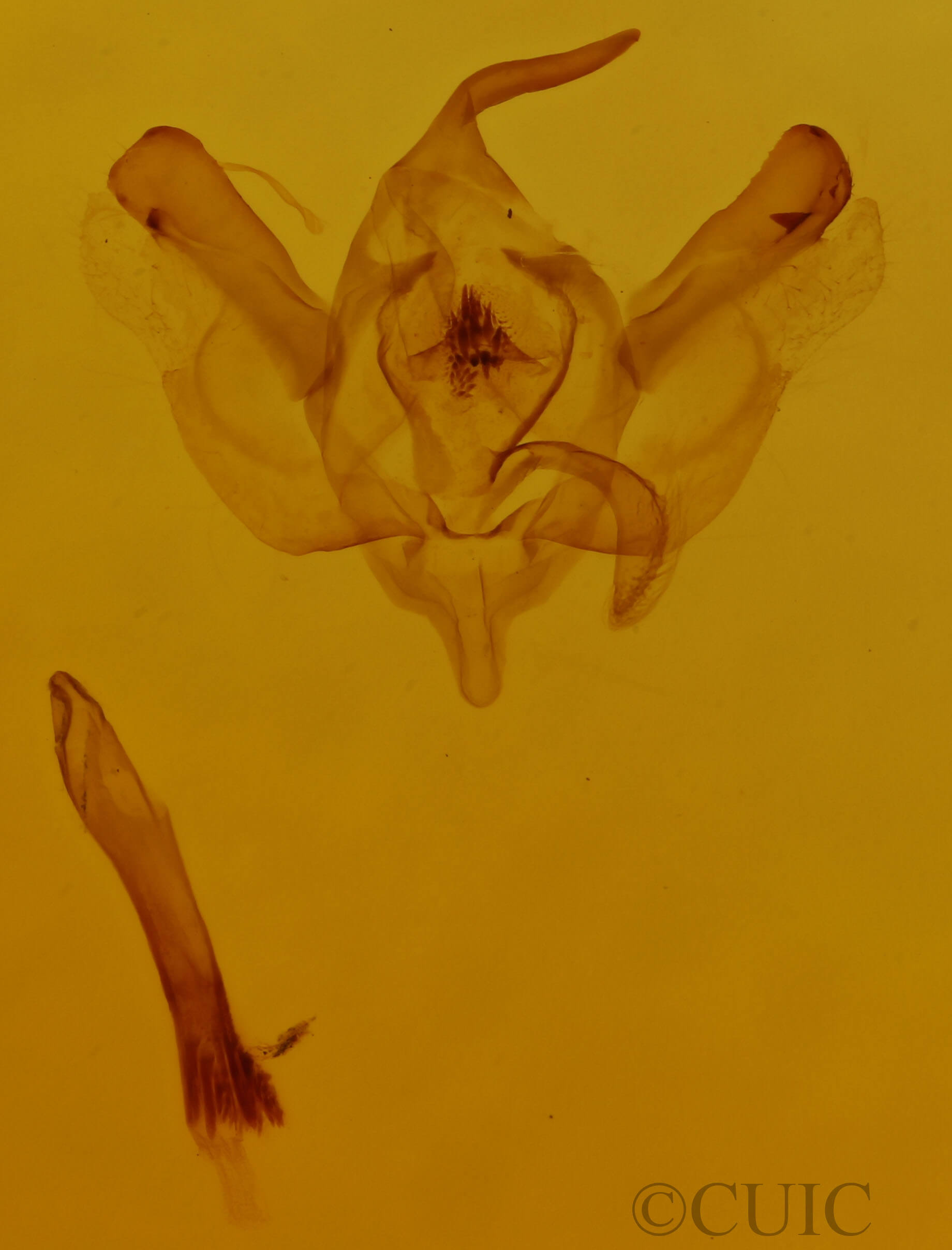 genitalia view of adult Xanthorhoe iduata