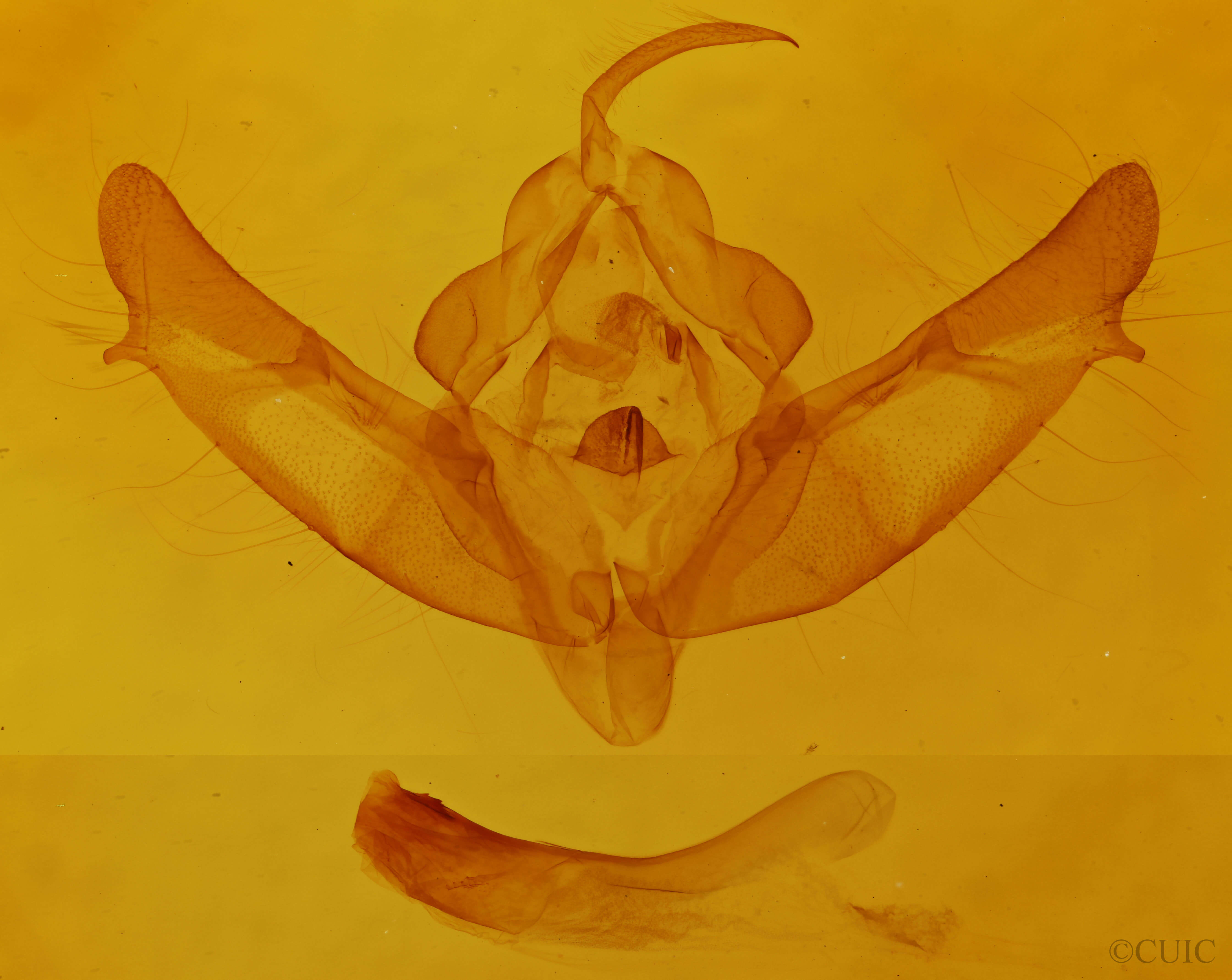 genitalia view of adult Xestia c-nigrum