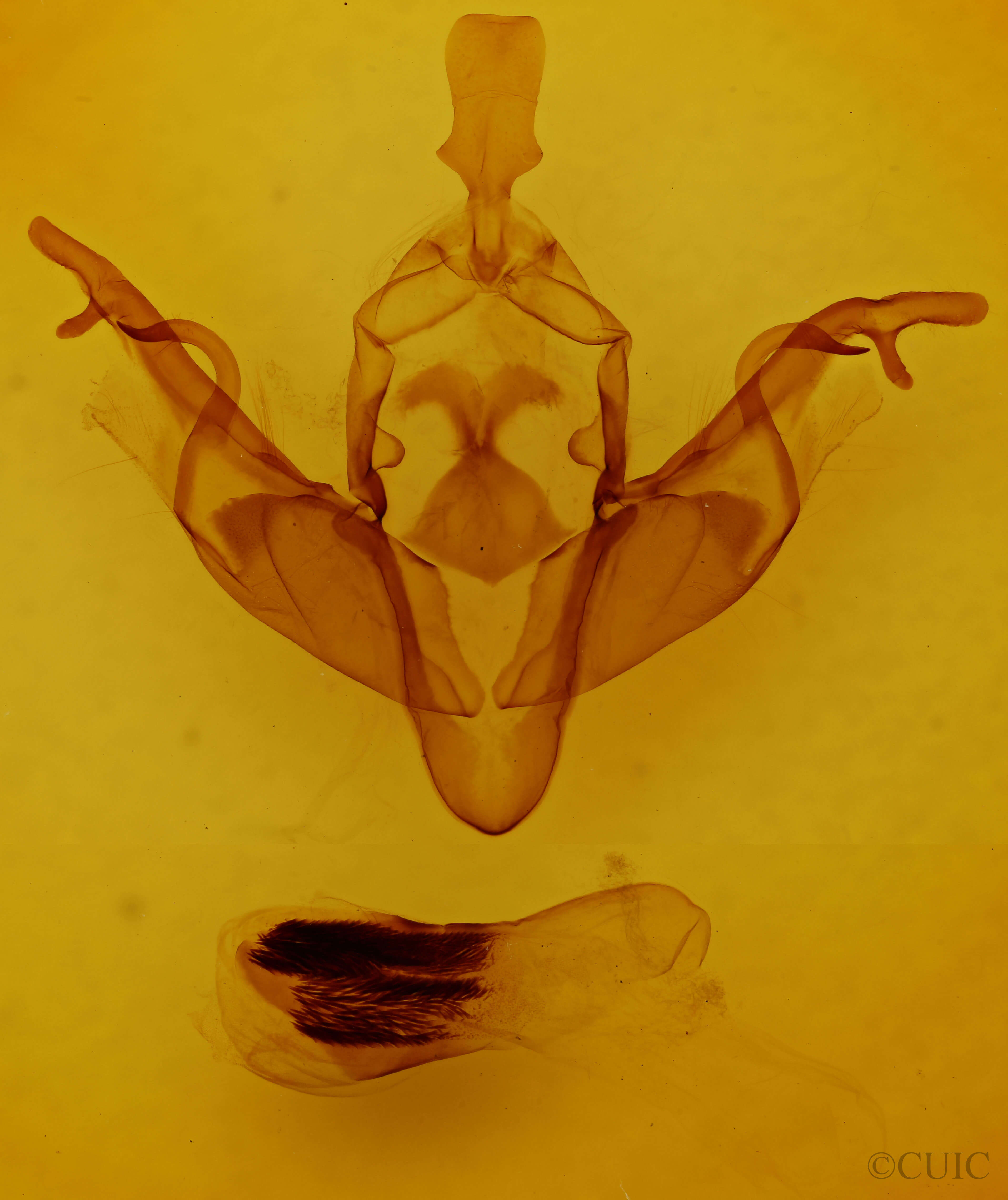 genitalia view of adult Xylena curvimacula
