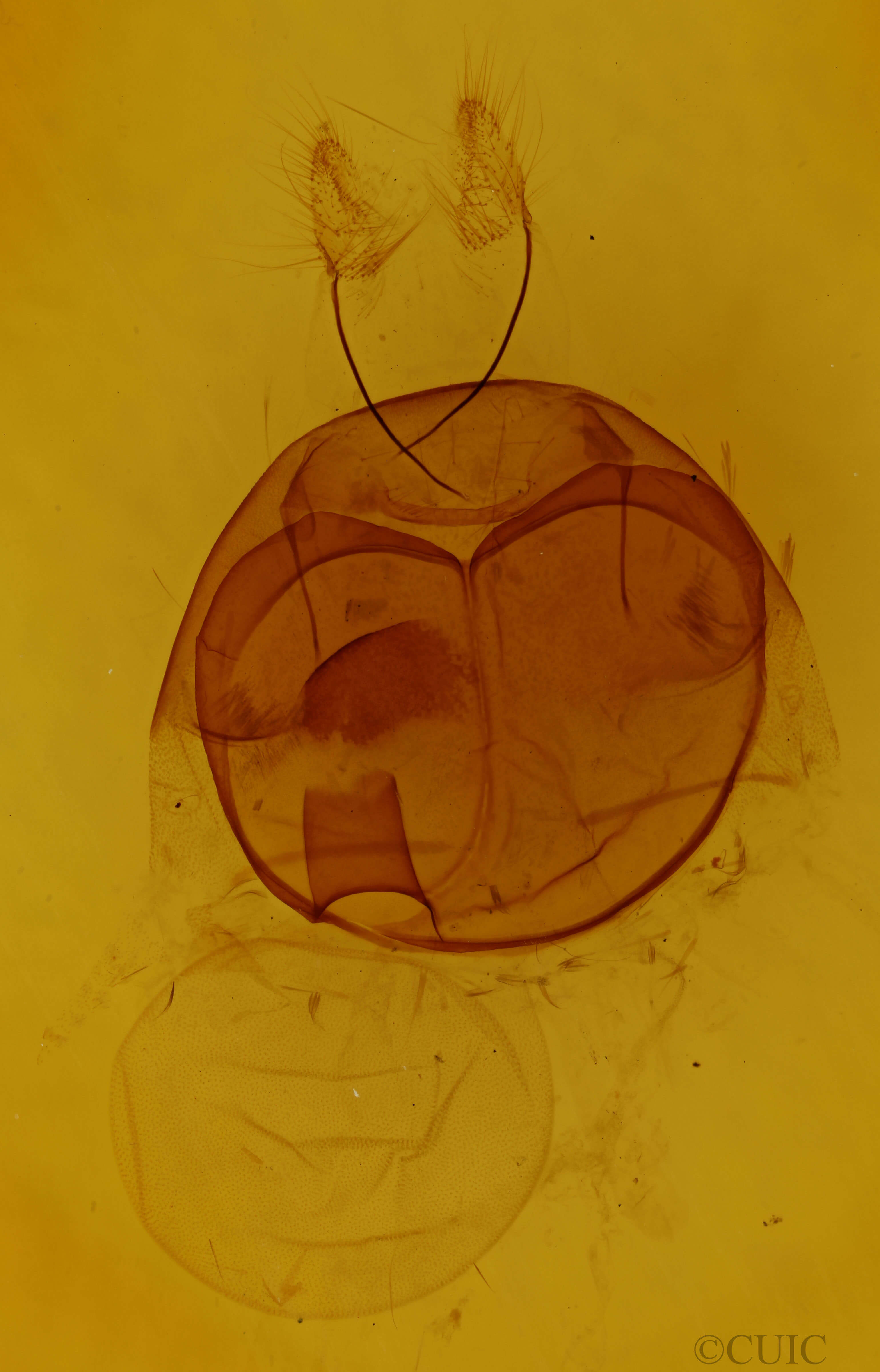 genitalia view of adult Zale duplicata