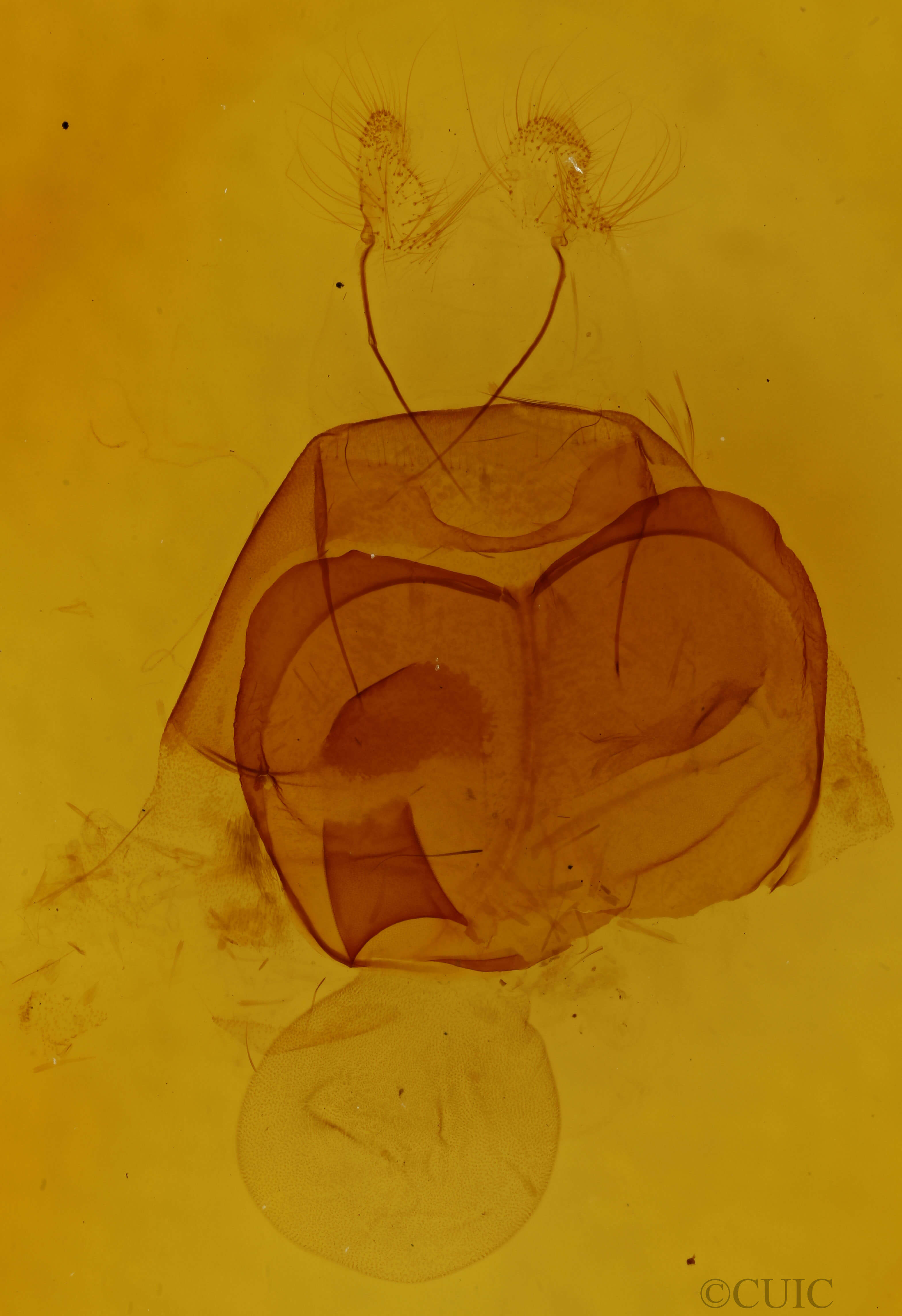 genitalia view of adult Zale duplicata