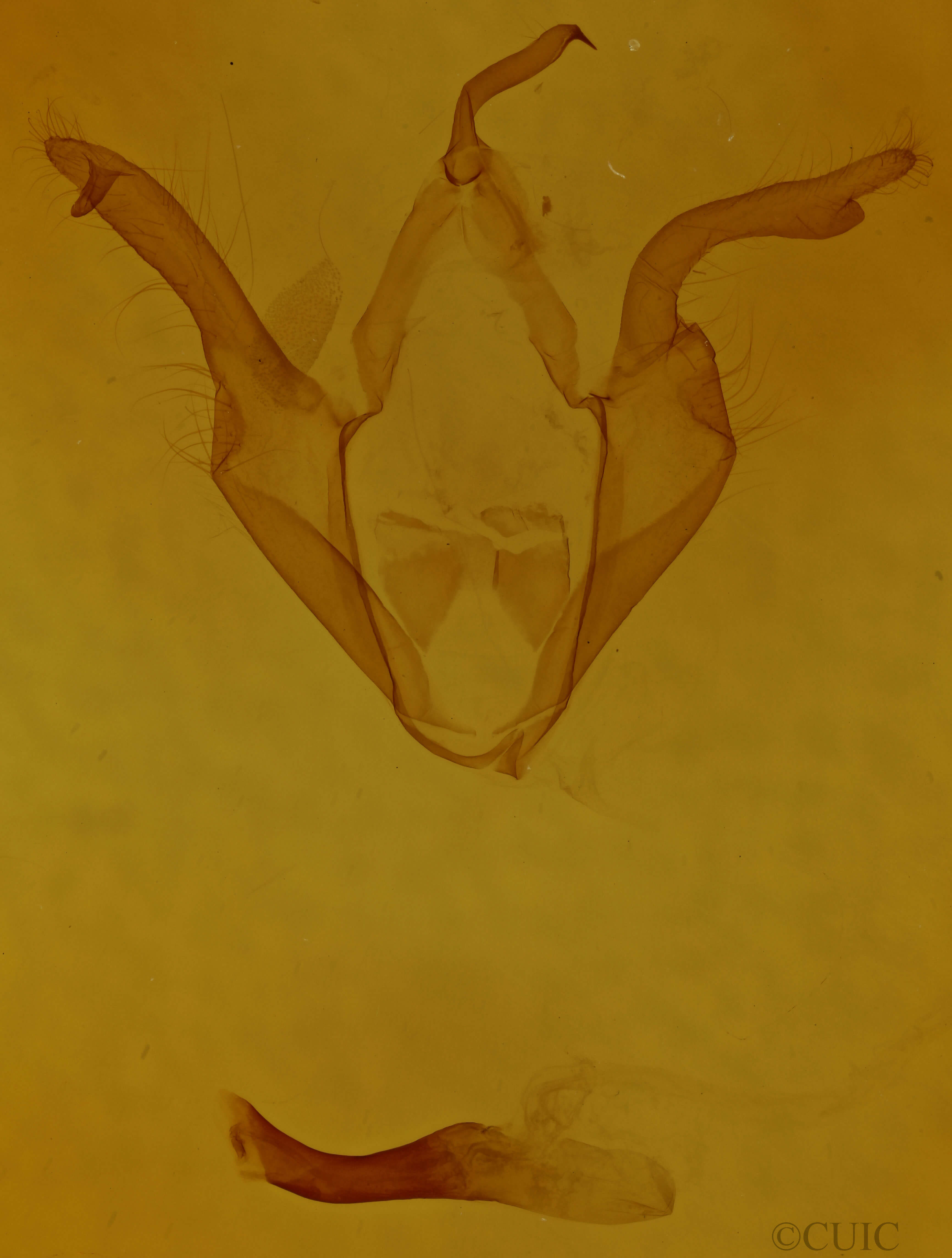 genitalia view of adult Zale